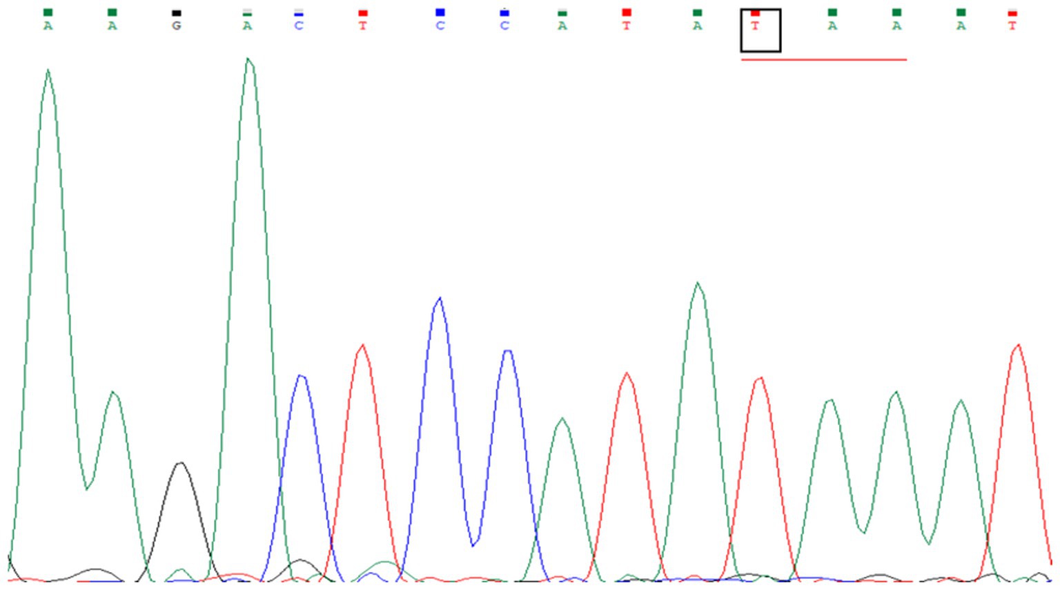 DNA sequencing chromatogram showing peaks in different colors representing nucleotides: green for adenine (A), black for guanine (G), blue for cytosine (C), and red for thymine (T). The sequence at the top reads