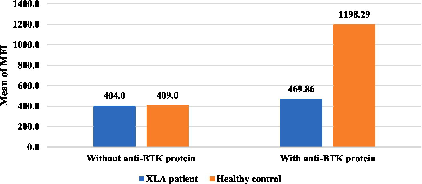 Bar chart comparing mean MFI levels in XLA patients versus healthy controls. Without anti-BTK protein: XLA patients show mean 404.0, controls 409.0. With anti-BTK protein: XLA patients show mean 469.86, controls 1198.29.