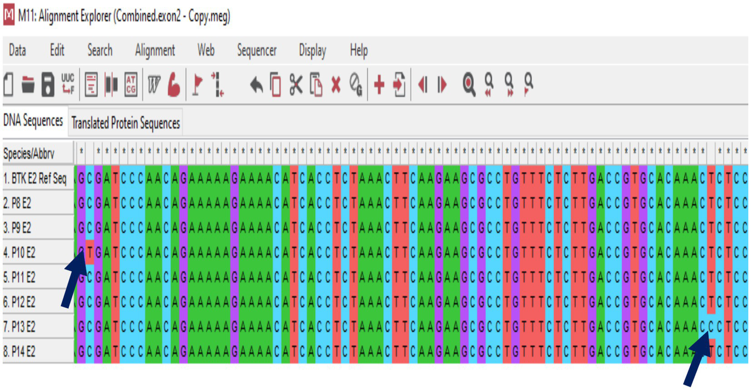 DNA sequence alignment displayed in a software interface labeled "Alignment Explorer" with tabs for DNA and protein sequences. The image shows sequences for different species or abbreviations, such as BTK E2 Ref Seq, P8 E2, and P9 E2, with nucleotides highlighted in various colors. Arrows point to specific nucleotides in rows four and six, marking differences or areas of interest. The toolbar includes options for editing, alignment, and viewing.