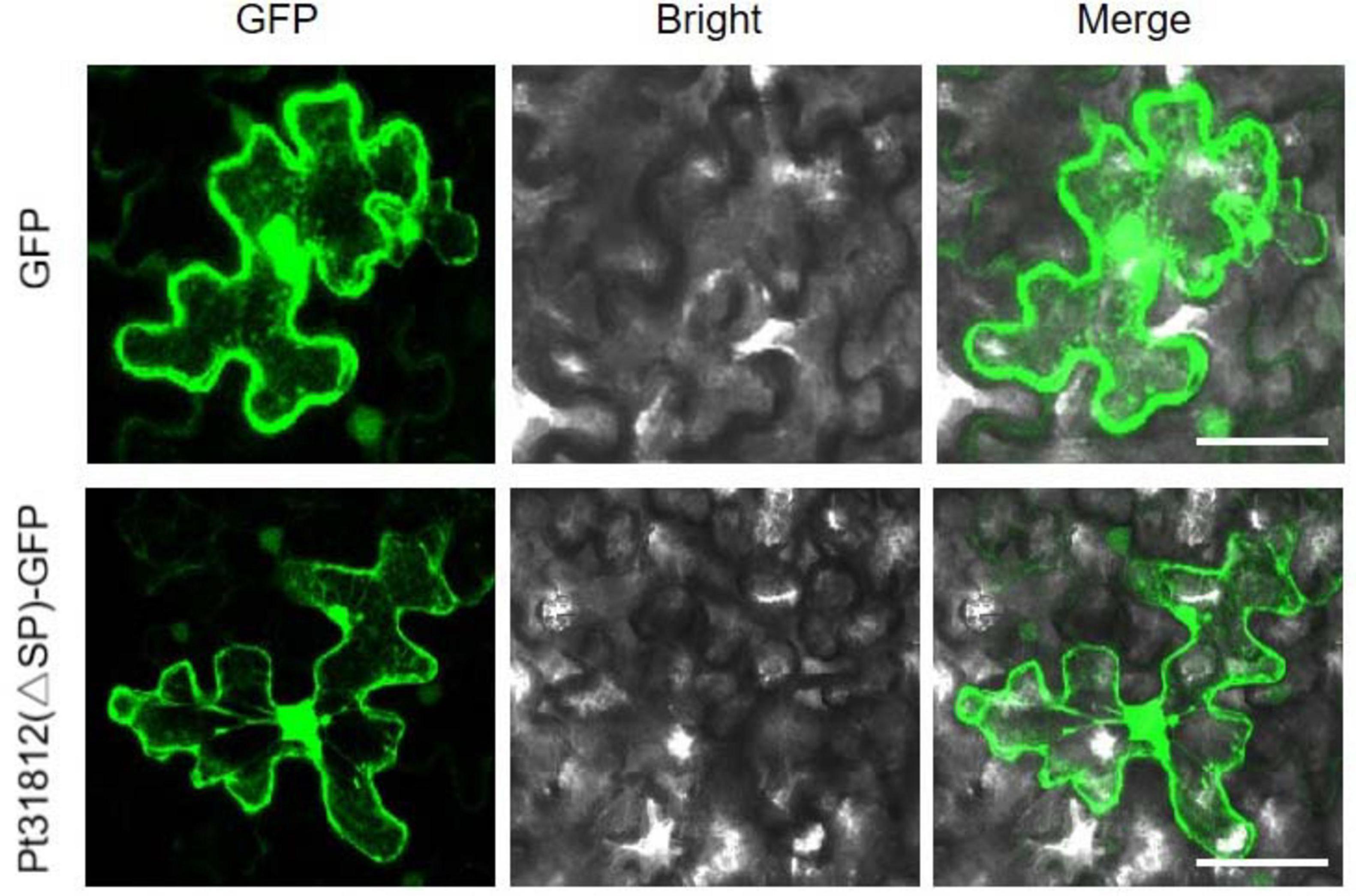 Fluorescent microscopy images showing leaf epidermal cells. The top row shows GFP expression with a bright field and merged images. The bottom row shows the P31812(?SP)-GFP variant with corresponding bright field and merged images. Green fluorescence highlights cellular structures against a grayscale background.