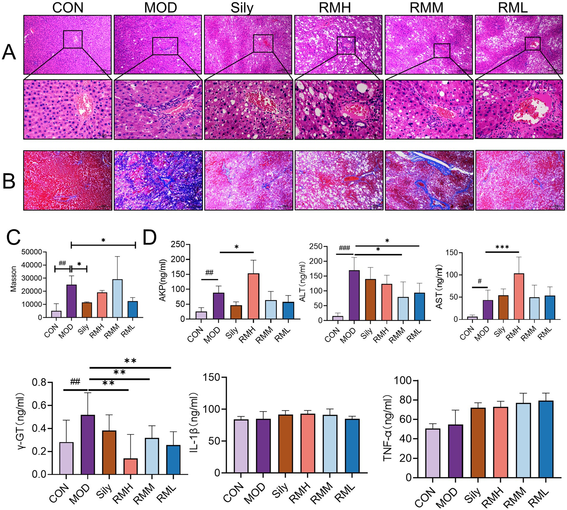 Panel A and B show histological images with different treatments (CON, MOD, Sily, RMH, RMM, RML), illustrating tissue changes. Panel C and D consist of bar graphs displaying levels of Masson, ALP, ALT, AST, γ-GT, IL-1β, and TNF-α across the same treatments. Significant differences are marked with asterisks.