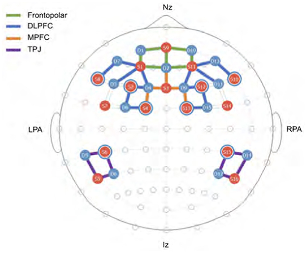 Diagram of a brain with source-detector pairs marked by colored lines on nodes. Green indicates Frontopolar regions, red for DLPFC, orange for MPFC, and purple for TPJ. Nodes are numbered and connected in a pattern showing neural pathways. Labels include Nz, LPA, RPA, and Iz.