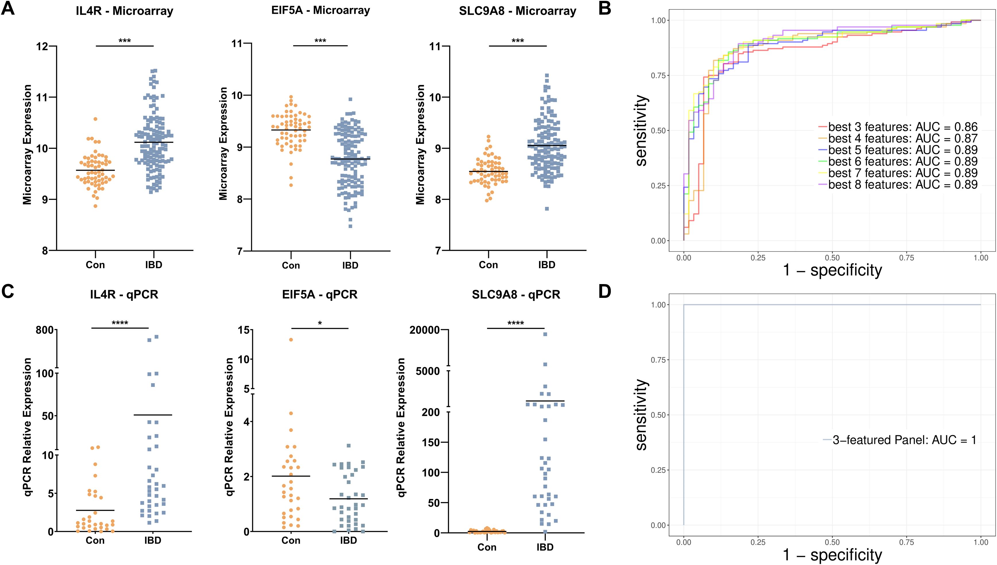 Panel A displays microarray expression data for IL4R, EIF5A, and SLC9A8, showing higher expression in IBD compared to controls. Panel B is an ROC curve with various feature sets, showing AUC values between 0.86 and 0.89. Panel C displays qPCR expression data, indicating higher IL4R, EIF5A, and SLC9A8 expression in IBD. Panel D shows an ROC curve with a three-feature panel achieving an AUC of 1.