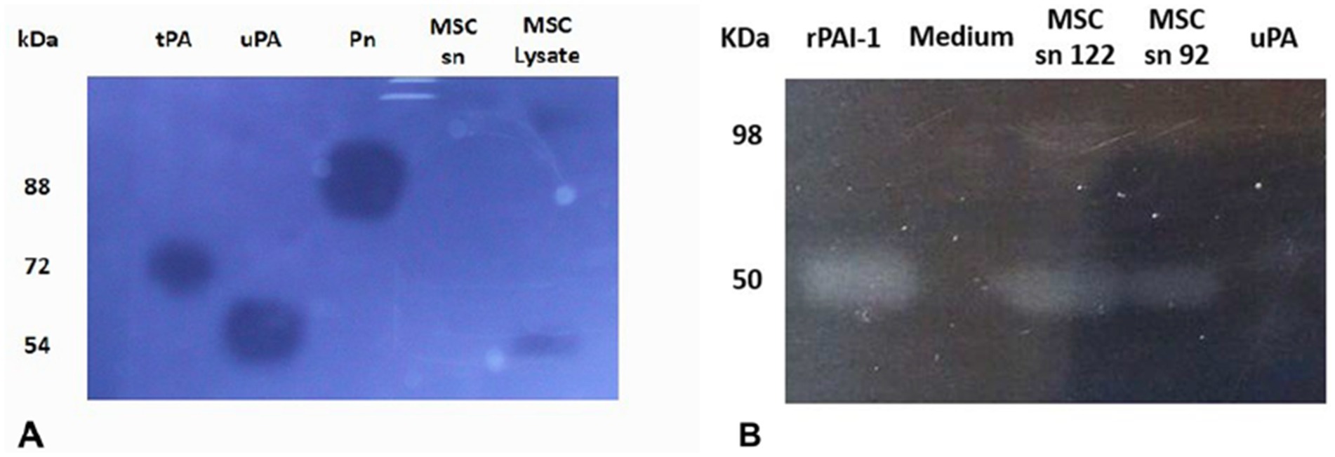 Panel A shows a zymography gel with fibrinolytic areas under labels tPA, uPA, Pn and MSC Lysate, marked by molecular weight on the left (88, 72, 54 kDa). Panel B displays a reverse zymography showing resistant fibrinolytic bands labeled rPAI-1, Medium, MSC sn 122, MSC sn 92, and uPA, with sizes marked as 98 and 50 kDa.