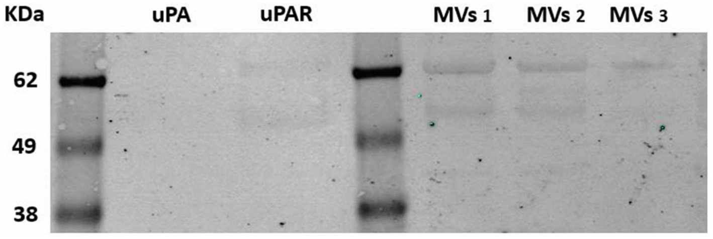 Western blot analysis shows protein bands labeled as uPA and uPAR beside lanes labeled MVs 1, MVs 2, and MVs 3. Molecular weight markers at 62, 49, and 38 kDa provide reference points for protein sizes.
