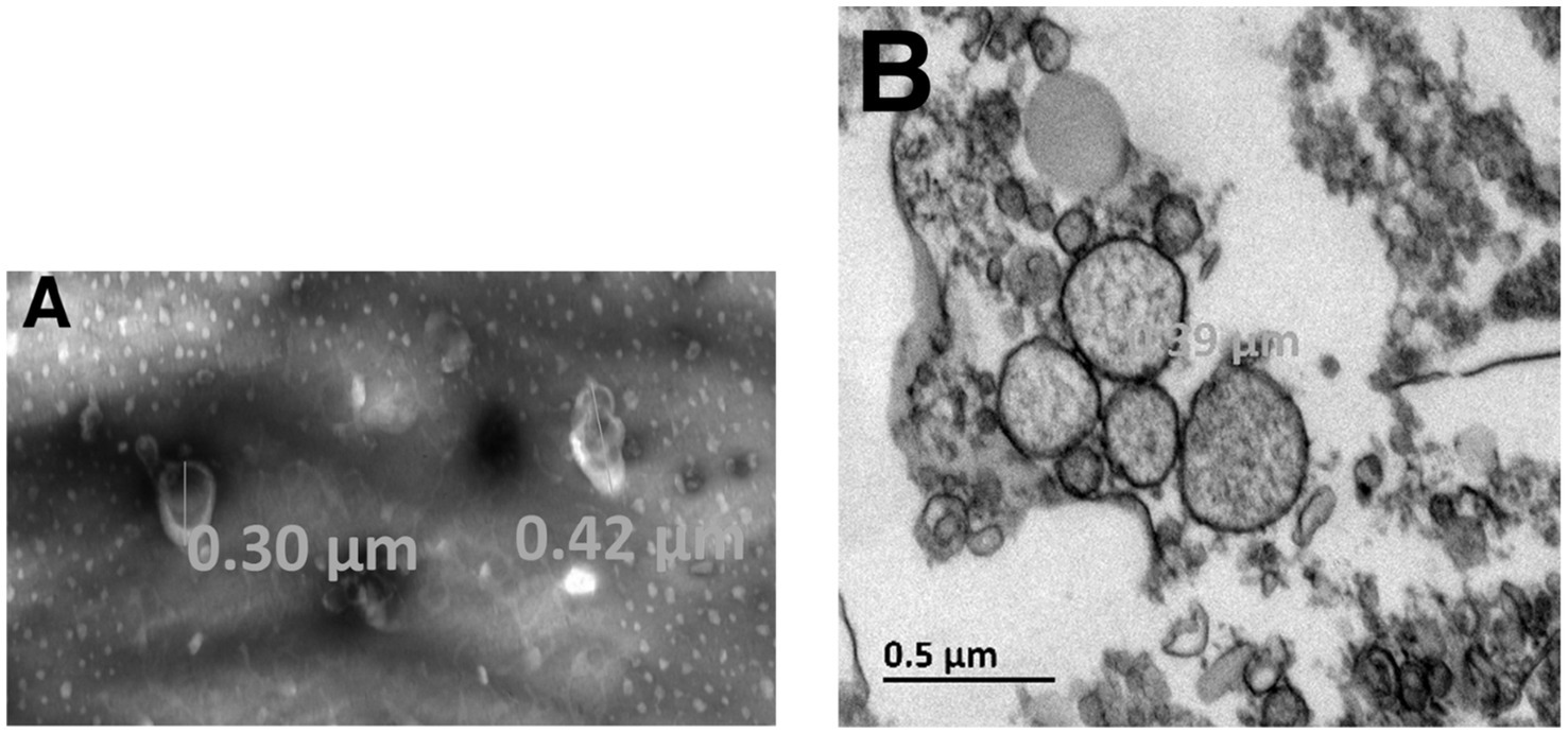 Panel A displays a microscopic image with microvesicles sized 0.30 and 0.42 micrometers, while panel B shows microvesicles with circular formations and a scale bar of 0.5 micrometers.