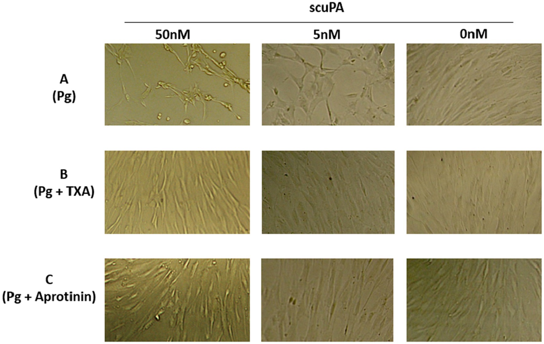 Microscopic images of cells are displayed in a grid. Three rows labeled A, B, and C, showing treatments: A (Pg), B (Pg + TXA), C (Pg + Aprotinin). Three columns show scuPA concentrations: 50 nM, 5 nM, and 0 nM. Row A shows changes in cell density and morphology with decreasing scuPA. Rows B and C show minimal changes across concentrations.