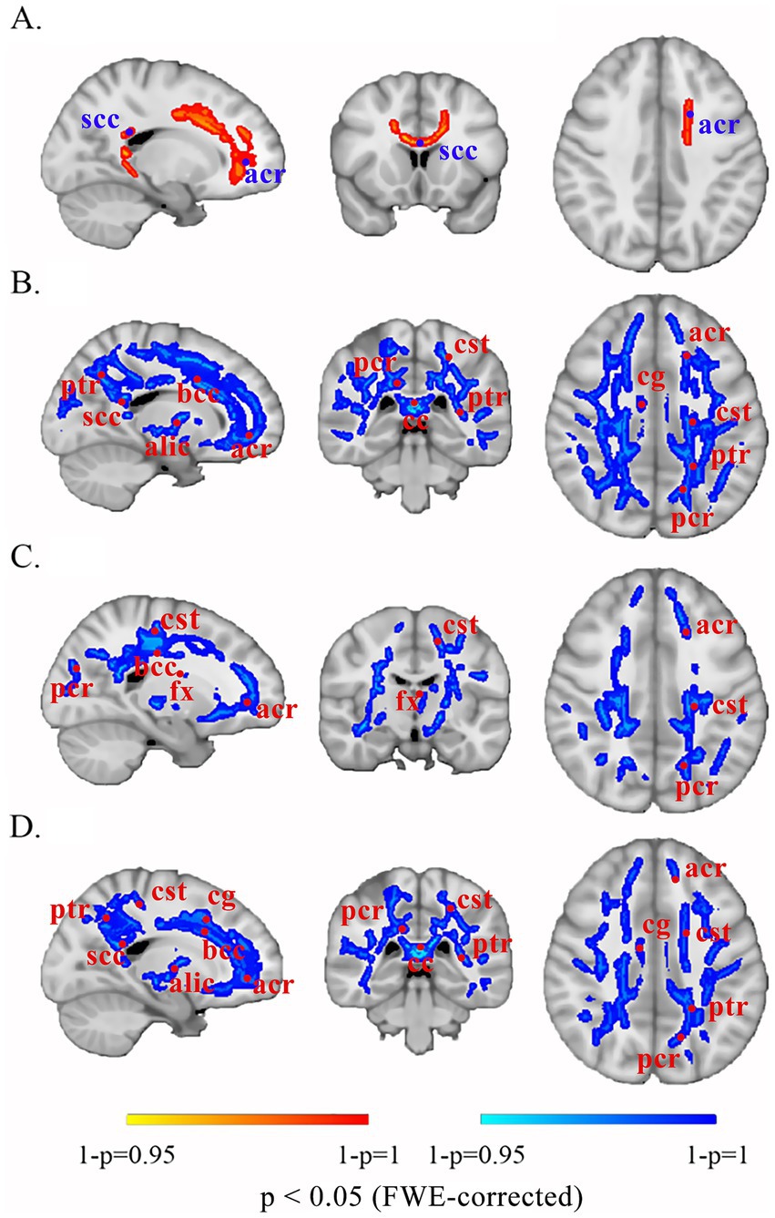 Brain images in four panels (A, B, C, D), displaying fiber tractography in different brain regions. Regions are highlighted in red and blue, with acronyms such as scc, acr, ptr, and more. A color scale at the bottom indicates statistical significance levels, with red to blue showing values from less than 0.05.
