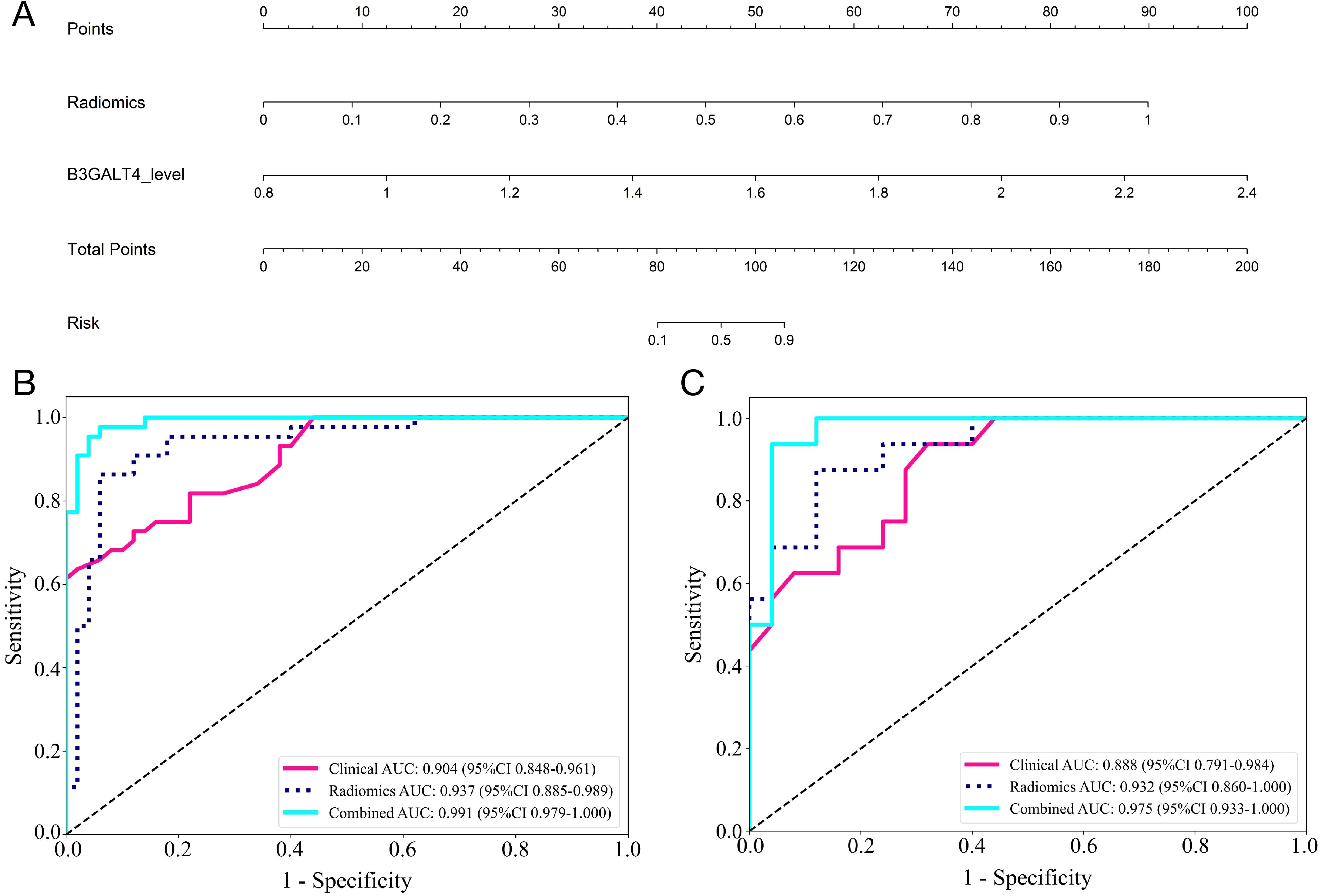 Panel A shows a nomogram predicting risk based on radiomics, B3GALT4 level, and total points. Panel B presents a ROC curve with sensitivity against 1-specificity for clinical, radiomics, and combined models with AUCs of 0.904, 0.937, and 0.991, respectively. Panel C shows a similar ROC curve with AUCs of 0.888, 0.932, and 0.975 for the same models.