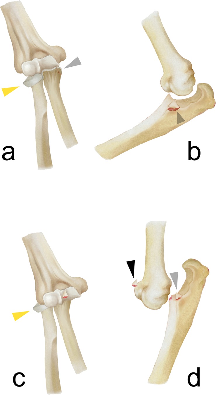 Illustration showing four views (a-d) of a joint with labeled components. Each view highlights different structural features with colored arrows pointing to specific areas of interest on the bone surfaces.
