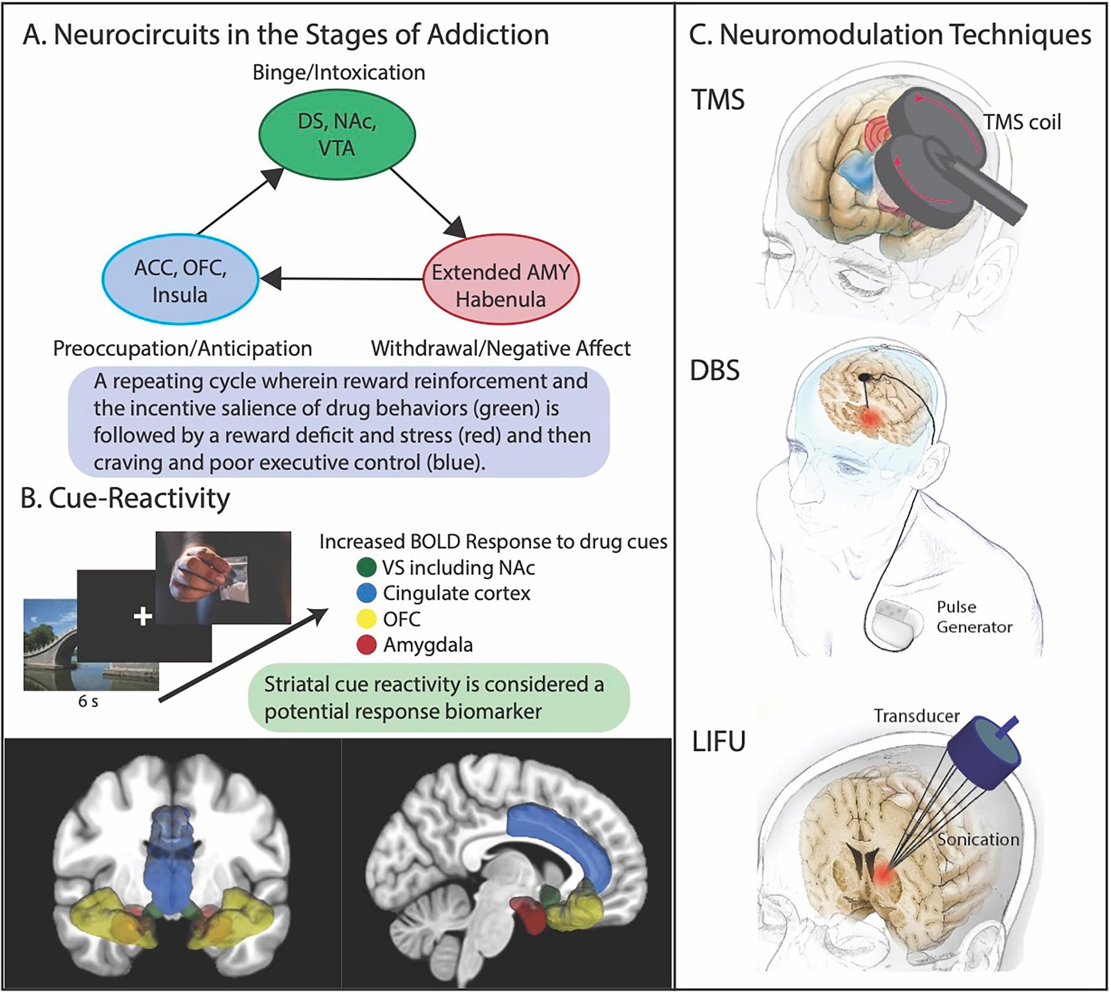 Diagram illustrating neurocircuits in addiction stages, cue-reactivity, and neuromodulation techniques. Part A shows circuits for binge, withdrawal, and anticipation stages involving regions like DS, NAc, VTA, and AMY. Part B presents cue-reactivity with brain images highlighting BOLD responses in regions such as NAc and amygdala. Part C depicts neuromodulation methods like TMS, DBS, and LIFU with brain illustrations showing treatment areas. Each section uses color-coded labels to indicate specific brain areas and responses.