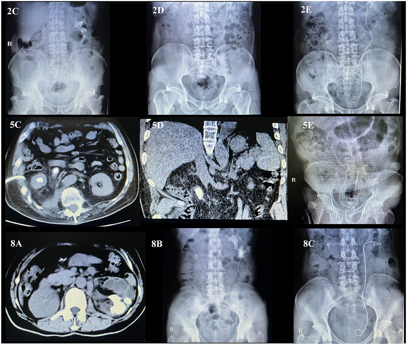 Sixteen abdominal CT scans displayed in a grid. Each image shows different sections and views of the abdominal region. Notable markers include a yellow arrow in image 3C indicating a specific feature, and a red arrow in image 4A pointing to another. The scans exhibit variations in tissue density and organ visibility across the grid.