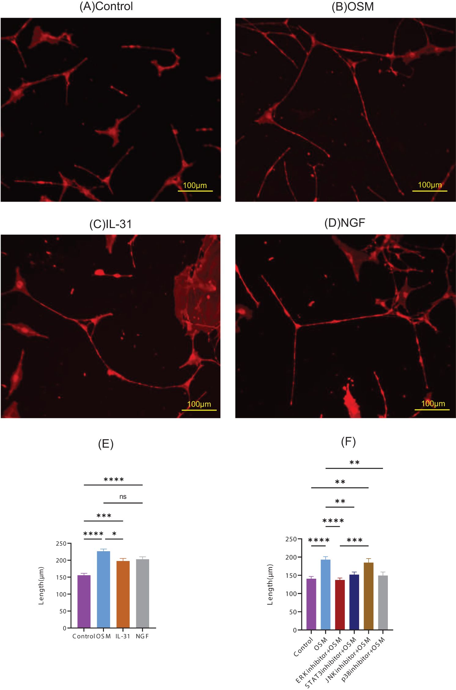 Fluorescence microscopy images are labeled (A) Control, (B) OSM, (C) IL-31, and (D) NGF, displaying cellular structures in red on a black background, with a scale bar of one hundred micrometers. Below, bar graphs (E) and (F) show the length measurements in micrometers. Graph (E) compares Control, OSM, IL-31, and NGF, with statistical significance indicated by asterisks. Graph (F) includes additional conditions with inhibitors, also marked with statistical significance.