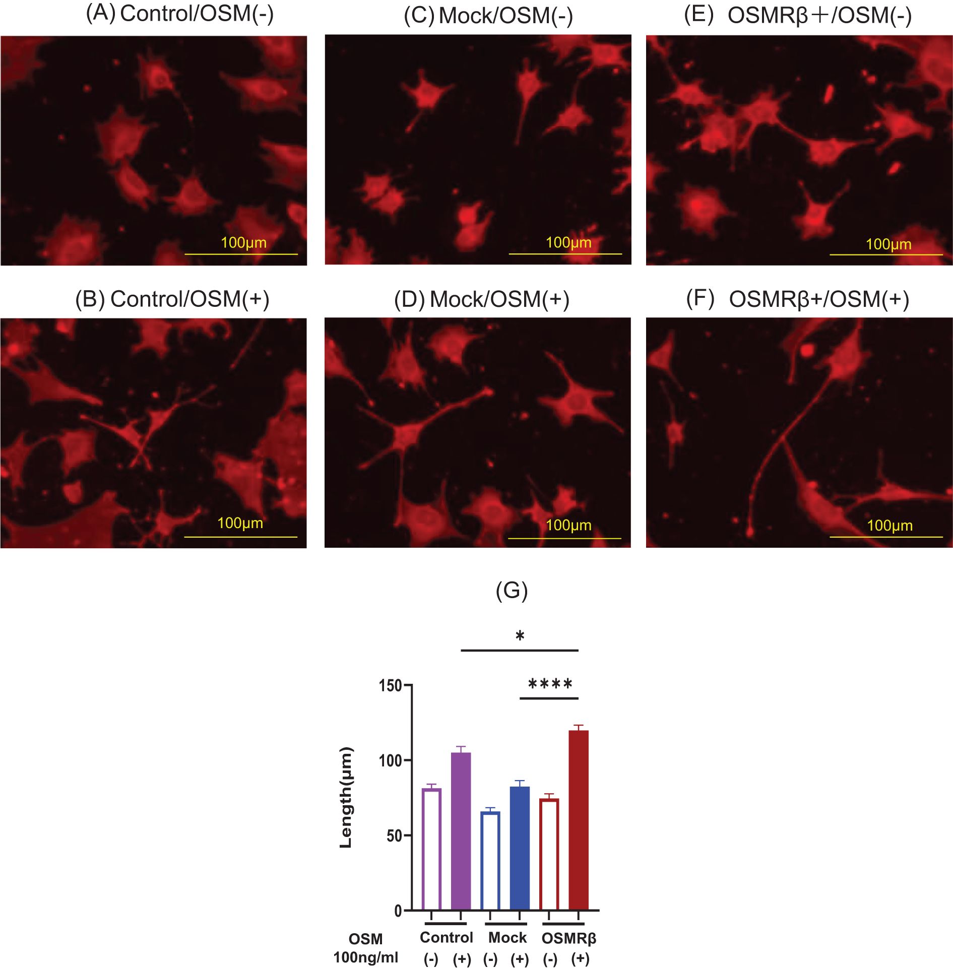 Fluorescent microscopy images showing six panels (A-F) of various cell conditions with oncostatin M (OSM) treatment indicated by (+) or (-). The scale bar in each image shows 100 micrometers. Below, a bar graph (G) compares the cell length under different conditions: Control, Mock, and OSMRβ, with and without OSM. A significant increase in cell length is noted in the OSMRβ(+)/OSM(+) group. Statistical significance is marked by asterisks.
