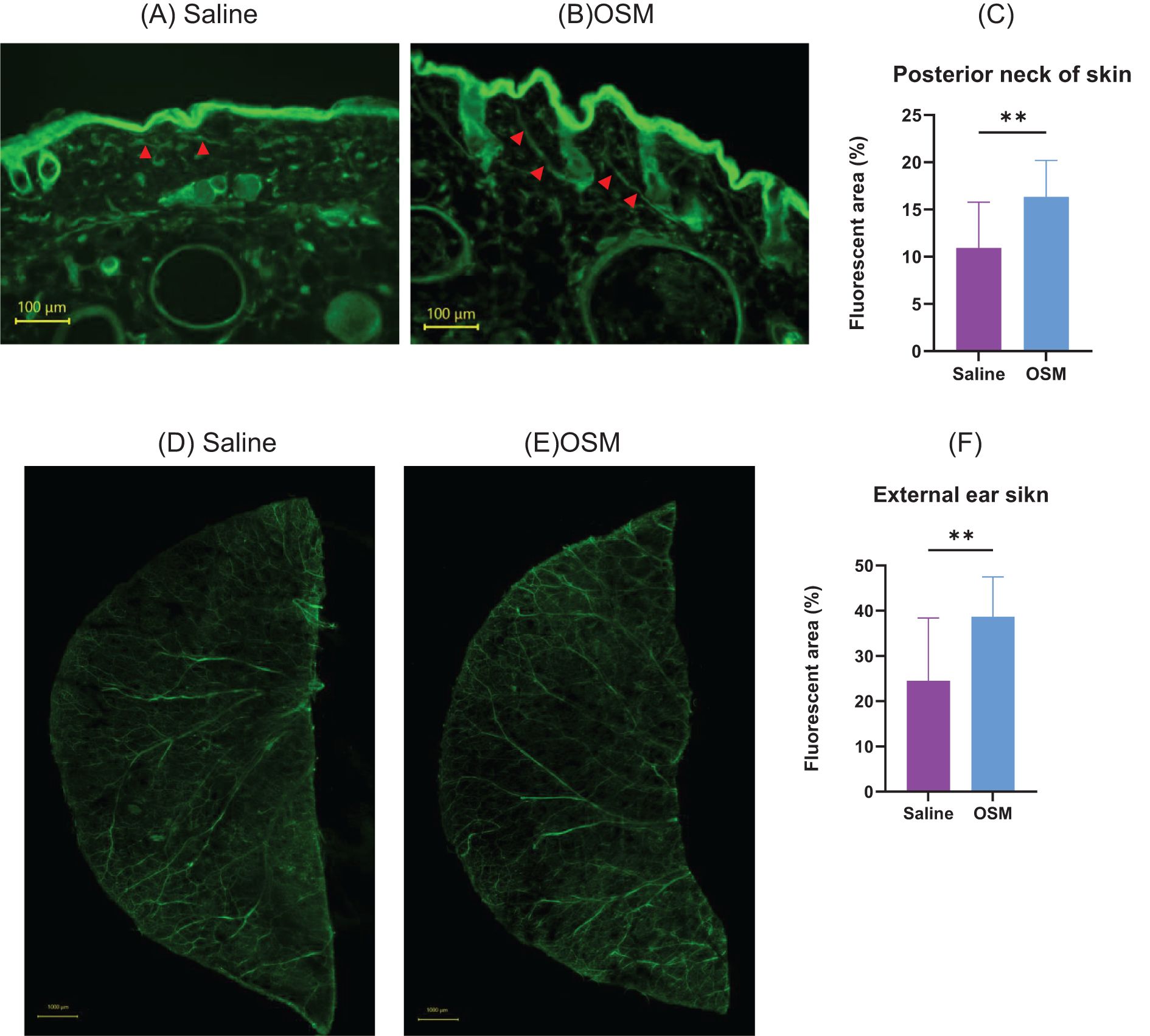 Fluorescent microscopy images and bar graphs comparing skin samples treated with saline and OSM. Panels (A) and (B) display the posterior neck of the skin, with green fluorescence indicating tissue features. Panel (C) is a bar graph showing increased fluorescent area percentage for OSM compared to saline. Panels (D) and (E) depict the external ear skin, with similar fluorescent patterns. Panel (F) is a bar graph indicating a higher fluorescent area percentage for OSM treatment. Red arrows highlight specific tissue regions. Scale bars indicate 100 micrometers.