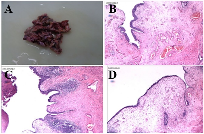 Panel A shows a specimen of tissue on a white background. Panels B, C, and D are microscopic images of tissue sections stained in pink and purple, showing varying cellular structures and patterns.