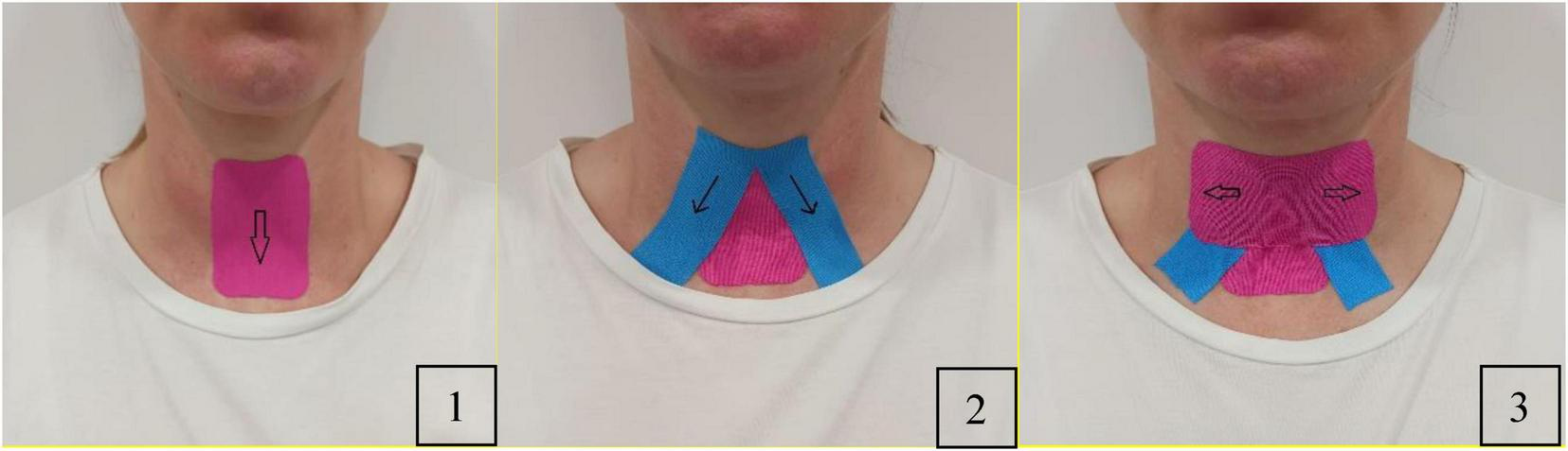 Close-up images showing three taping techniques on a person’s neck. Image 1 displays a pink tape with a downward arrow. Image 2 shows pink tape with blue strips angled downwards. Image 3 features pink tape with crossed blue strips at the sides.