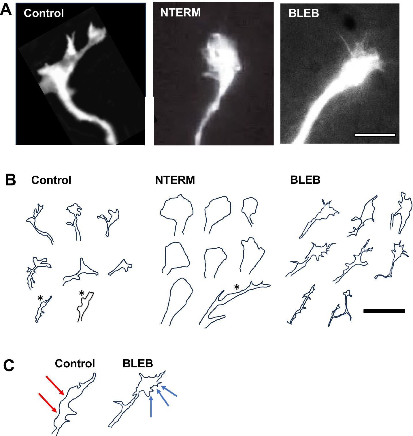 Three panels depict cellular structures analyzed under different conditions. Panel A shows fluorescent images labeled as Control, NTERM, and BLEB, illustrating cellular forms. Panel B presents line drawings of the structures corresponding to Control, NTERM, and BLEB, highlighting shape variations. Panel C includes enlarged views of Control and BLEB forms, with red arrows on Control and blue arrows on BLEB, indicating specific features.