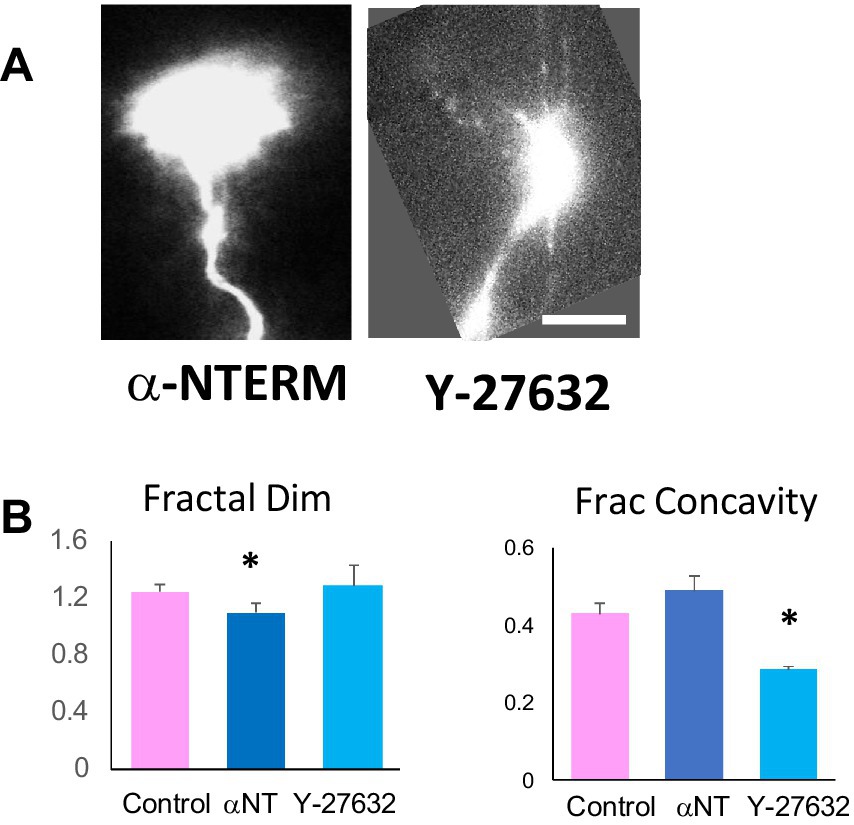 Two panels are shown. Panel A contains two images of cells: one labeled α-NTERM, showing a bright, neuron-like structure, and the other labeled Y-27632, displaying a similar structure with less brightness and clarity. Panel B presents bar graphs comparing fractal dimension and fractional concavity among Control, α-NT, and Y-27632 groups. The fractal dimension graph shows a higher value for α-NT, while the fractional concavity is higher for Y-27632, both indicated with asterisks.