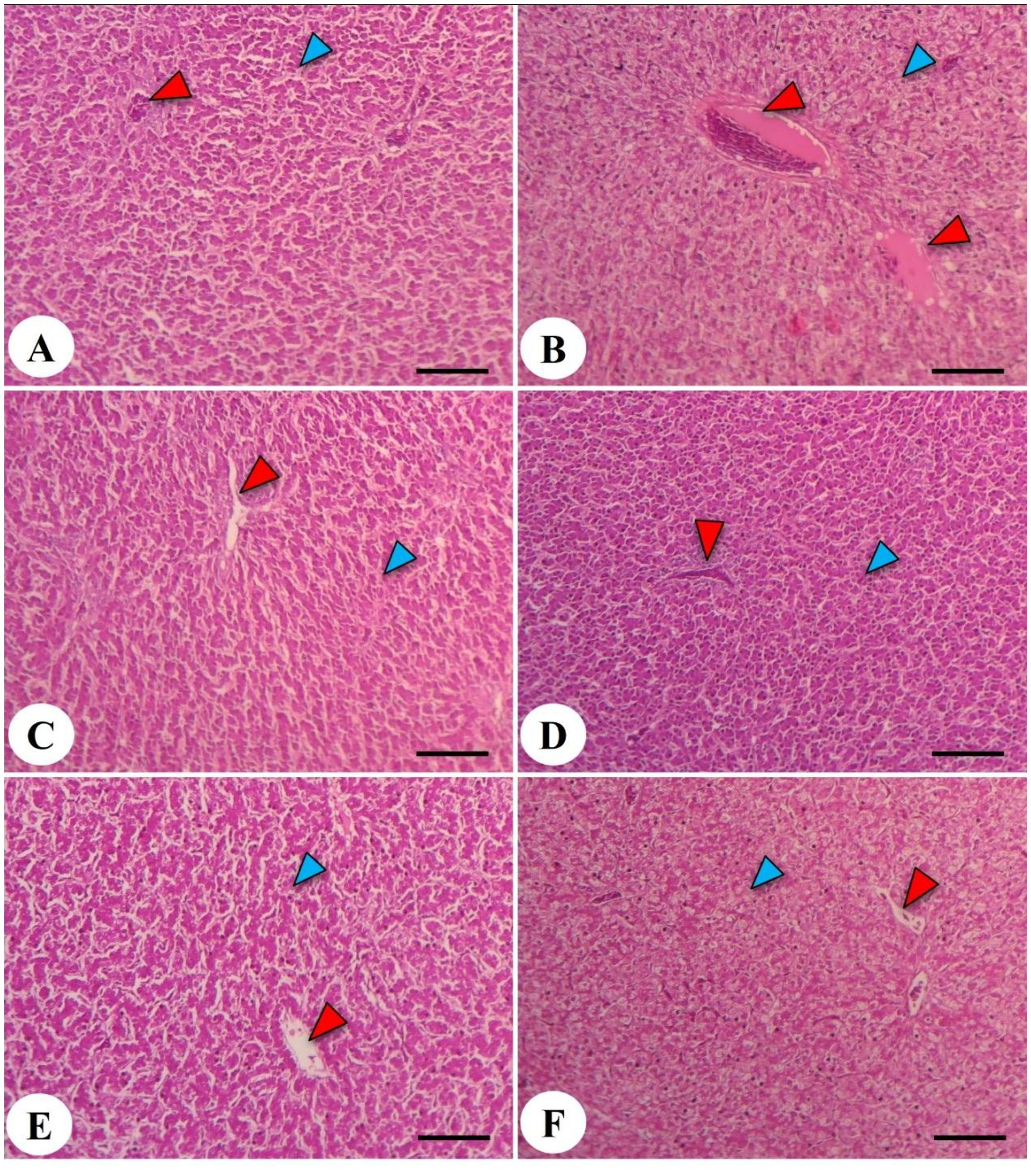 Histology slides labeled A to F showing liver tissue sections with red and blue arrowheads indicating different structures. The pink and purple staining highlights cellular details like sinusoids and central veins. The scale bars are visible at the bottom of each image.
