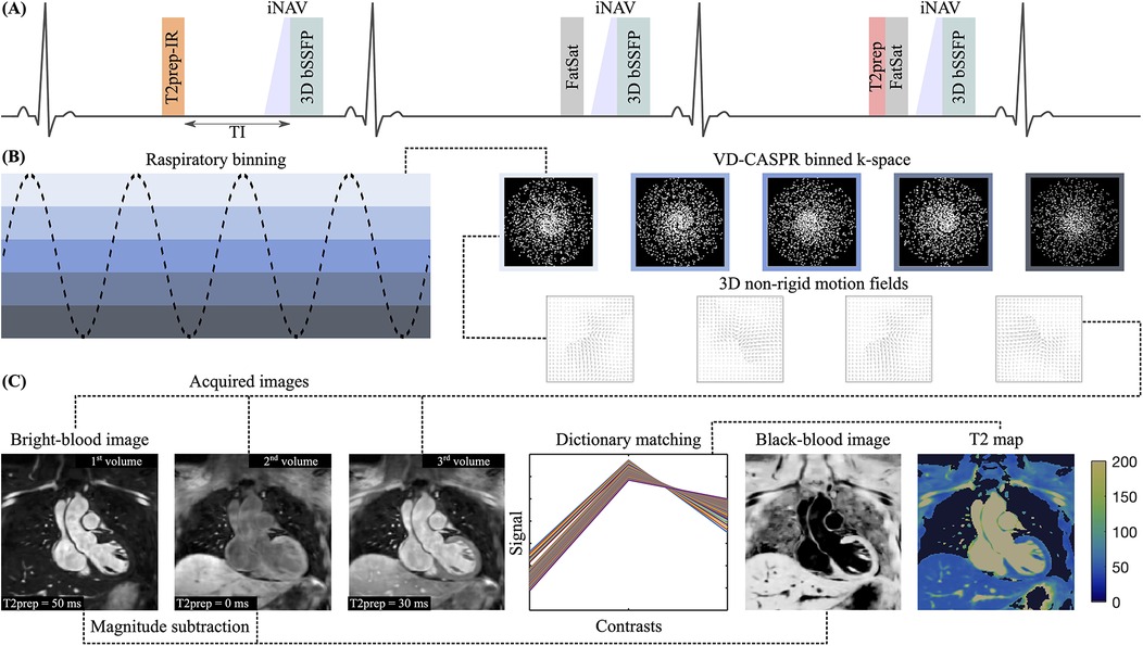 Diagram illustrating a cardiac MRI process. Panel A shows a heart rate graph with labels for T2prep-IR and 3D bSSFP. Panel B depicts respiratory binning with wave patterns leading to VD-CASPR binned k-space and 3D motion fields. Panel C displays acquired images: bright-blood images for three volumes with T2prep times, a signal contrast graph for dictionary matching, and resulting black-blood image and T2 map with color scale from 0 to 200.
