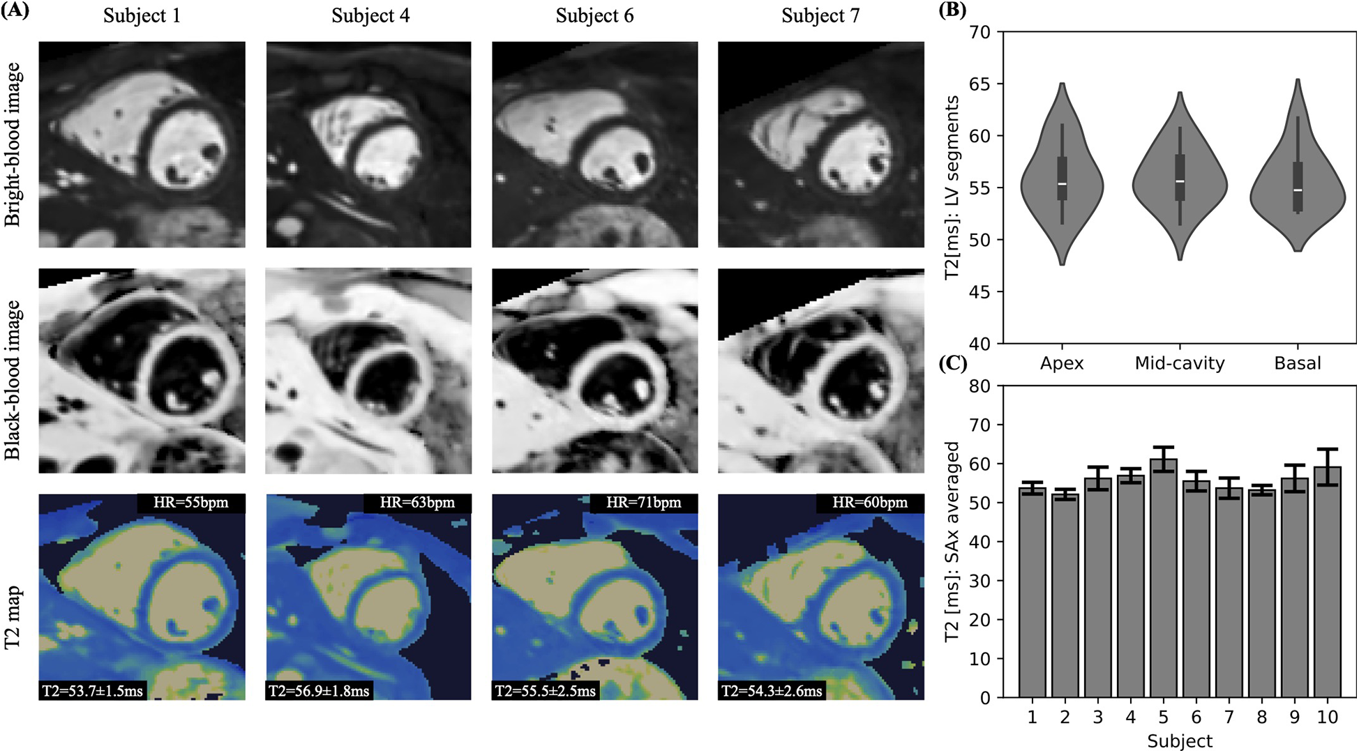 (A) Cardiovascular MRI images for four subjects, showing bright-blood, black-blood, and T2 maps, with heart rates and T2 times annotated. (B) Violin plots displaying T2 times in milliseconds across left ventricular segments: apex, mid-cavity, and basal. (C) Bar graph illustrating averaged T2 times for ten subjects, with error bars indicating variability.
