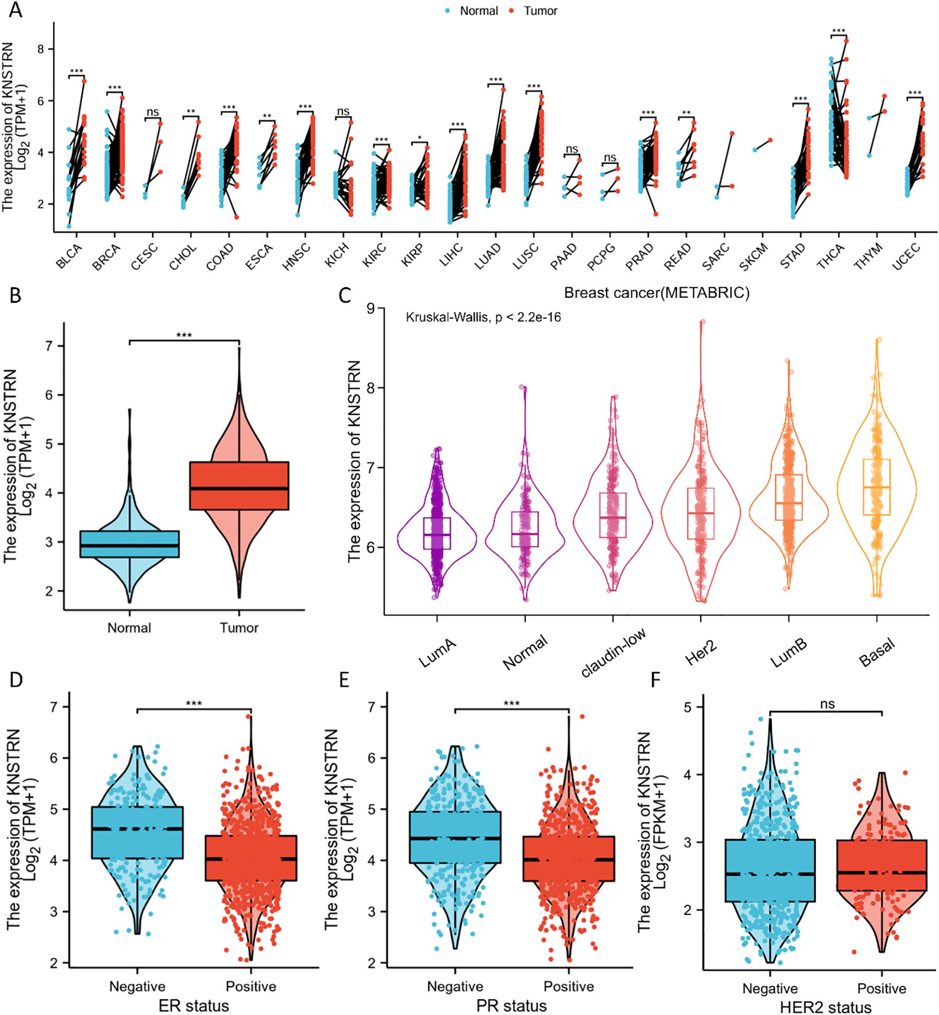 Grouped plots showing the expression of KNSTRN gene across various conditions. Panel A: Box plots for normal vs. tumor across multiple cancer types, with statistical significance indicated. Panel B: Violin plot comparing normal and tumor samples, showing higher expression in tumors. Panel C: Violin plots for breast cancer subtypes from METABRIC, indicating significant expression differences. Panels D to F: Violin plots showing expression by ER, PR, and HER2 statuses, with significant differences noted in ER and PR but not HER2. Statistical significance is marked with asterisks.