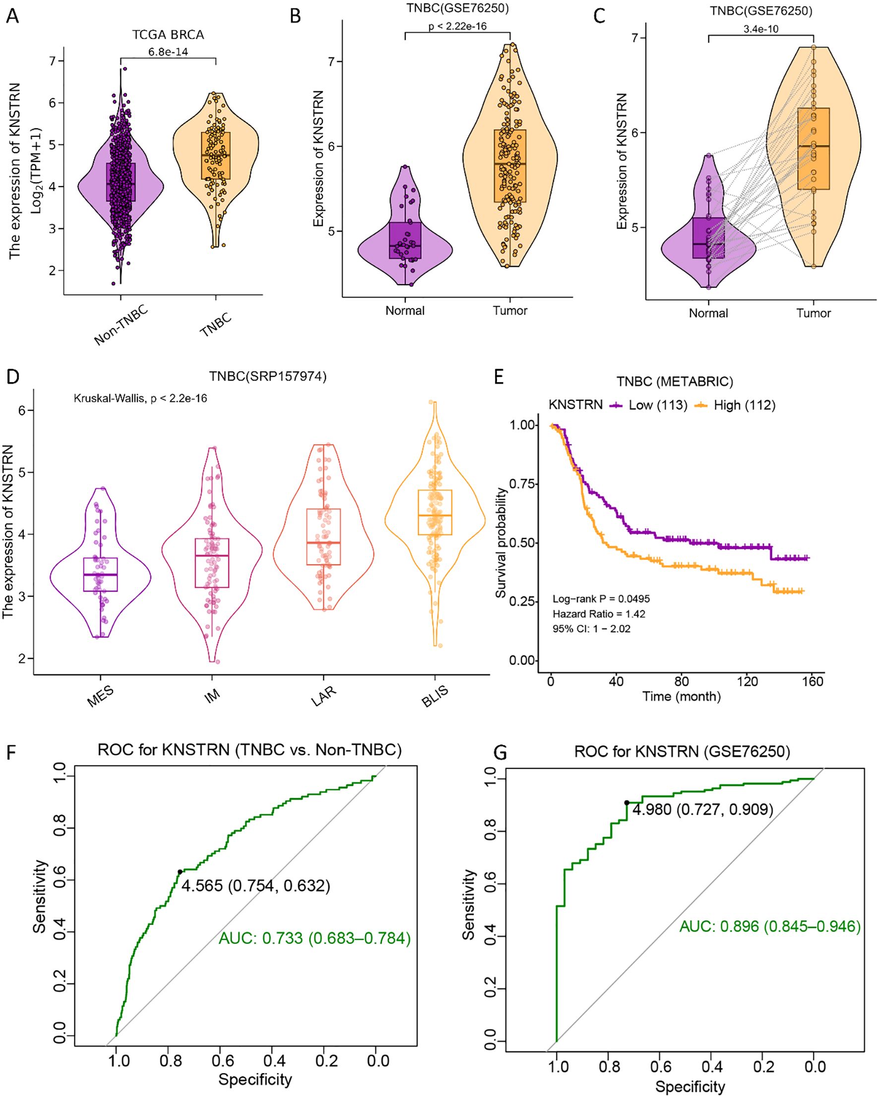 Panel of graphs analyzing KNSTRN expression. (A to D) Violin plots show KNSTRN expression in different conditions: non-TNBC vs. TNBC, normal vs. tumor, and TNBC subtypes with statistical significance indicated. (E) Kaplan-Meier survival curve compares low and high KNSTRN expression groups in TNBC, with a log-rank p-value and hazard ratio. (F and G) ROC curves for KNSTRN in TNBC vs. non-TNBC and GSE76250 dataset, displaying AUC values for diagnostic performance.
