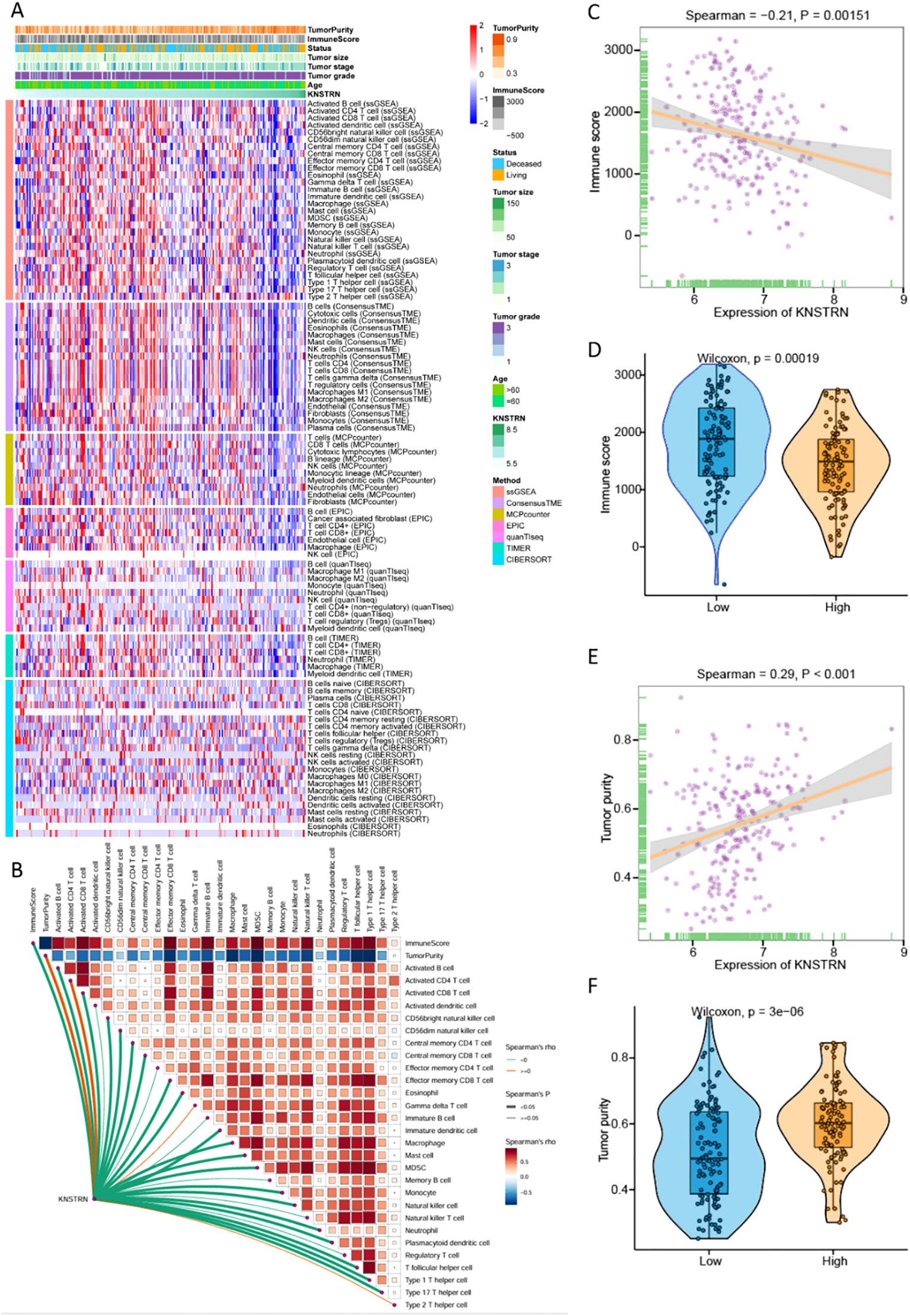 Heatmap (A) shows associations of tumor purity, immune score, status, size, stage, and grade with various immune signatures. Correlation matrix plot (B) indicates relationships between immune cells and tumor characteristics. Scatterplots (C and E) display negative and positive correlations of KNSTRN expression with immune score and tumor purity, respectively. Violin plots (D and F) illustrate differences in immune score and tumor purity between low and high KNSTRN expression groups, emphasizing statistical significance with p-values.