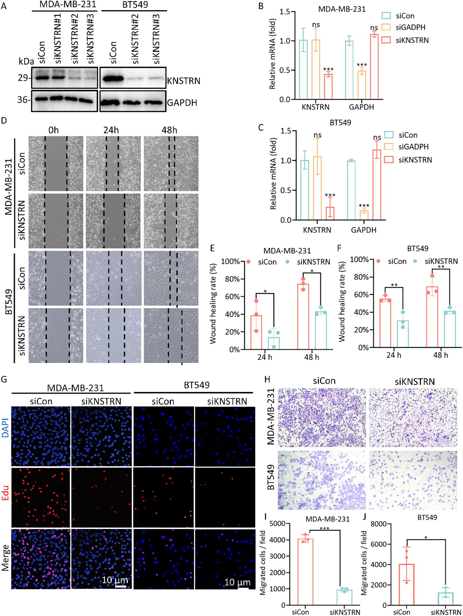 Experimental data showing the effects of KNSTRN knockdown on MDA-MB-231 and BT549 cell lines. Panel A: Western blots for KNSTRN and GAPDH. Panels B and C: Bar graphs of relative mRNA levels in MDA-MB-231 and BT549, showing significant decrease with siKNSTRN. Panel D: Wound healing assays at 0, 24, and 48 hours, indicating reduced migration in siKNSTRN cells. Panels E and F: Bar graphs showing reduced wound healing rates. Panel G: EdU incorporation assays display decreased proliferation with siKNSTRN. Panel H: Images of migrated cells in transwell assays. Panels I and J: Bar graphs of migrated cell counts, showing significant reduction in siKNSTRN samples.