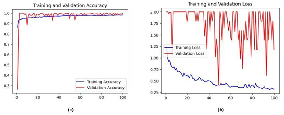 Three rows of ultrasound segmentation results. Each row includes an original grayscale ultrasound image (left), its ground truth mask (middle), and the model's predicted mask (right). The masks show tumors in white on a black background. Predicted masks closely match the shape and location of the ground truth, reflecting effective segmentation performance.