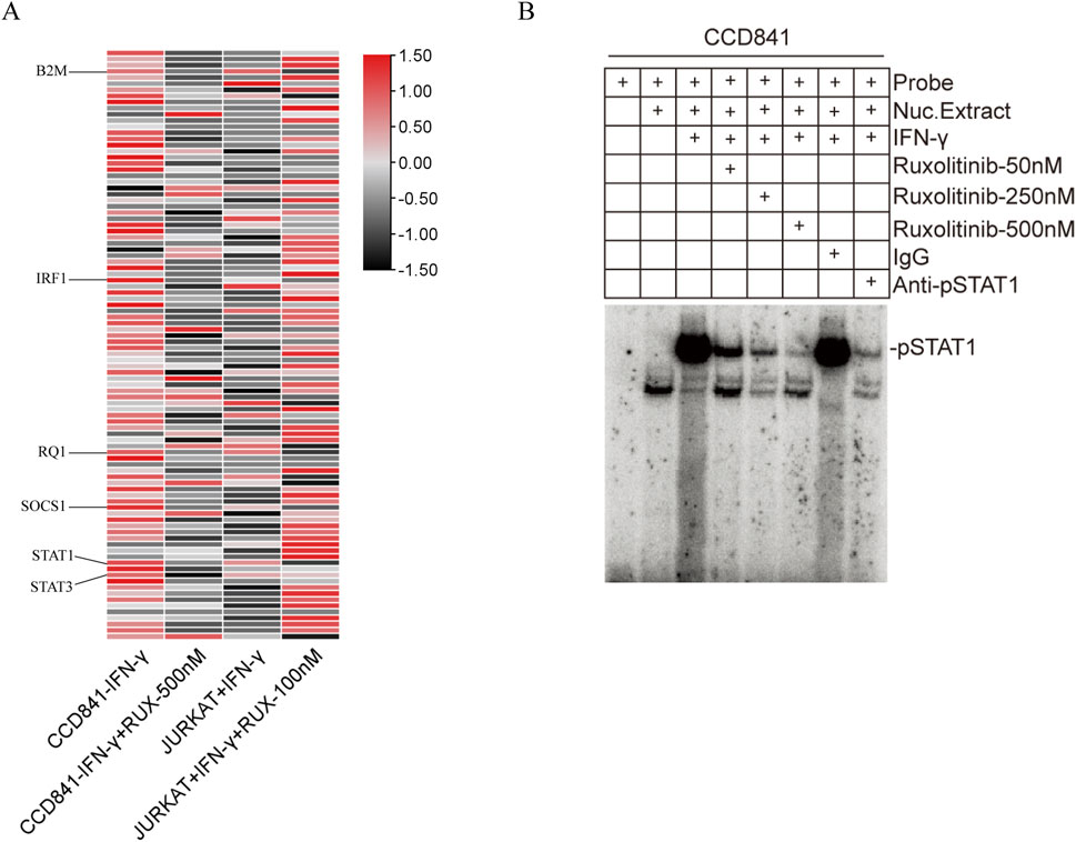Panel A shows a heat map of gene expression, with intensity ranging from red to black, for genes B2M, IRF1, RQ1, SOCS1, STAT1, and STAT3 in different conditions. Panel B displays an electrophoretic mobility shift assay with a grid indicating the presence of various reagents and bands showing pSTAT1 protein levels under different conditions.