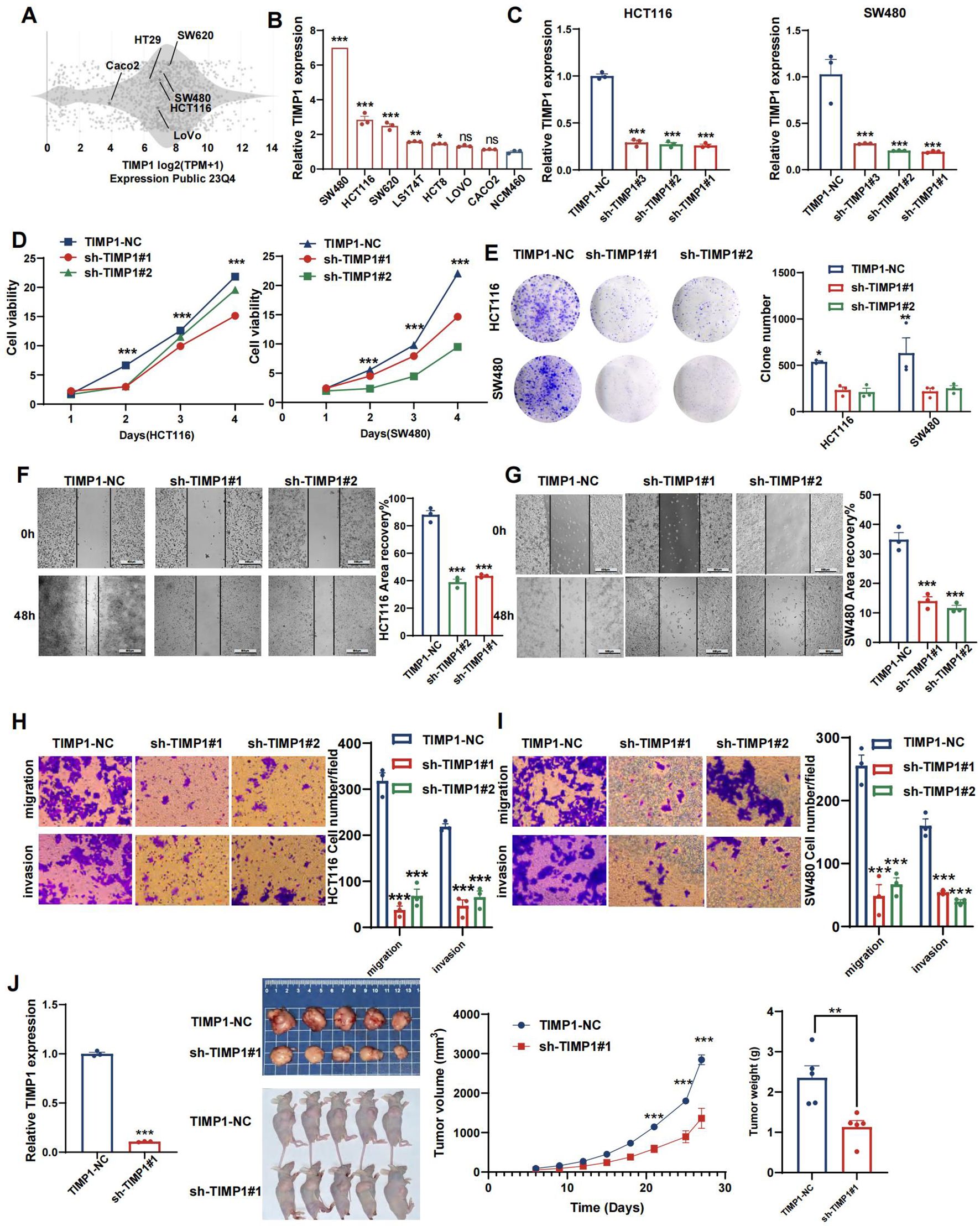 Scientific figures illustrate various analyses on TIMP1 expression and its effects on cell behavior. Panels (A-J) display data on relative TIMP1 expression across different cell lines, cell viability, colony formation, wound healing assays, migration and invasion assays, and in vivo tumor growth. Graphs, images, and bar charts detail the effects of TIMP1 knockdown using shRNA compared to controls, highlighting differences in expression, cell behavior, and tumor growth metrics. Statistical significance is marked with asterisks.