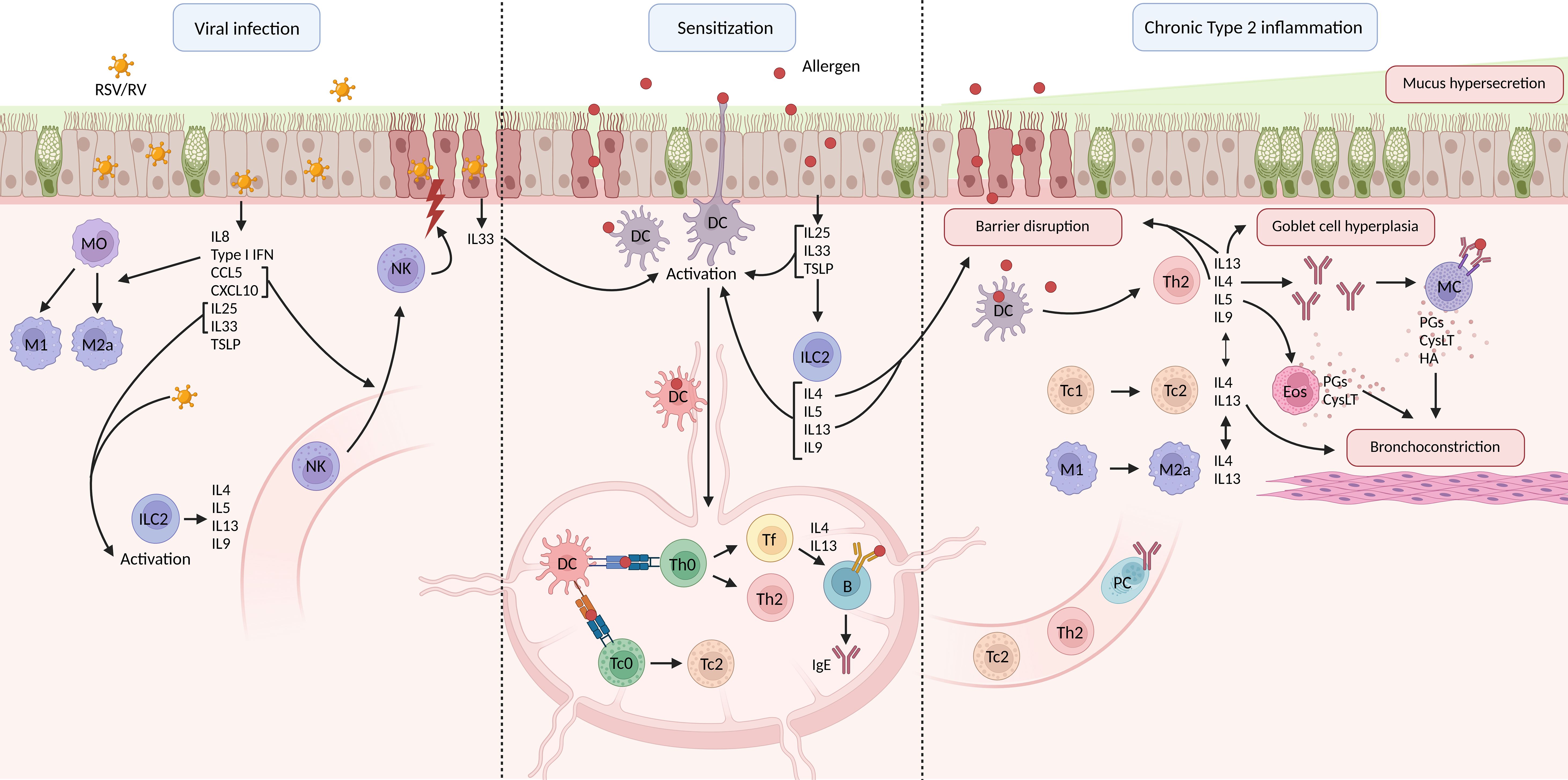 Diagram illustrating the process of chronic type 2 inflammation, divided into three stages: viral infection, sensitization, and chronic inflammation. The viral infection stage shows RSV/RV causing cytokine release. The sensitization stage involves allergens activating dendritic cells and ILC2 cells, with cytokine exchange. The chronic inflammation stage shows barrier disruption, goblet cell hyperplasia, and mucus hypersecretion. Key cells like NK, DC, Th2, Tc, MC, Eos, M1, and M2a are depicted, highlighting their roles in inflammation and bronchoconstriction, with various interleukins and cytokines involved.