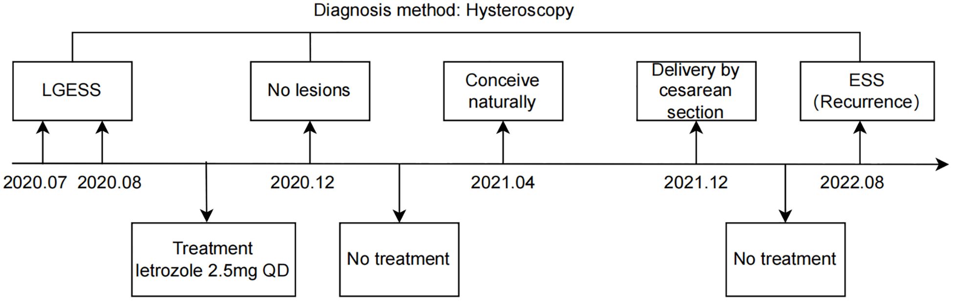 Timeline illustrating a medical case diagnosed by hysteroscopy. In July and August 2020, LGESS is identified and treated with 2.5 mg letrozole. By December 2020, no lesions are observed. In April 2021, natural conception occurs. In December 2021, delivery by cesarean section is performed. In August 2022, ESS reoccurrence is noted, with no treatment following.