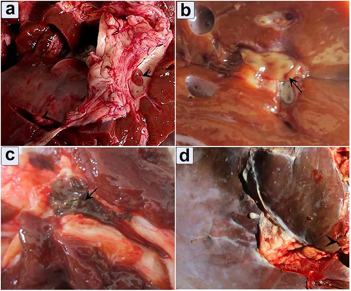 Four panel image showing various liver pathologies. Panel a shows a liver with fibrous tissue, indicated by an arrow. Panel b highlights bile duct abnormalities with an arrow pointing to a lesion. Panel c presents necrotic tissue with an arrow marking the affected area. Panel d exhibits liver discoloration with an arrow pointing to a fibrous section.