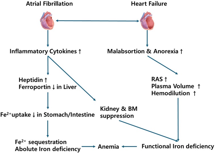 Flowchart illustrating the relationship between atrial fibrillation and heart failure with iron deficiency. Atrial fibrillation increases inflammatory cytokines, leading to increased heptidin and decreased ferroportin in the liver, reducing iron uptake in the stomach and intestines, causing sequestration and absolute iron deficiency. This results in anemia. Heart failure causes malabsorption and anorexia, increasing renin-angiotensin system (RAS) activity, plasma volume, and hemodilution, leading to kidney and bone marrow suppression, and functional iron deficiency, also contributing to anemia.