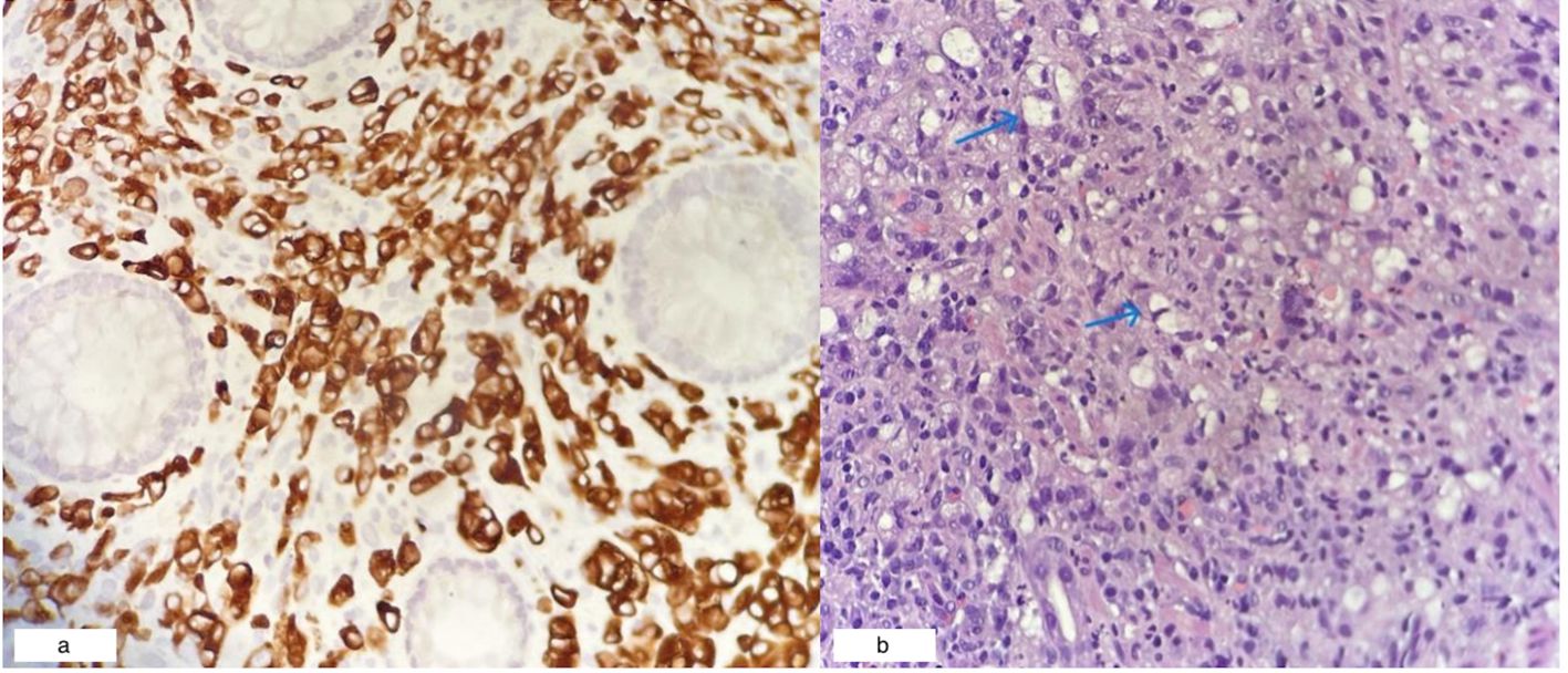 Two histological images side by side. Figure 4a shows a tissue section stained with dark brown highlighting distinct cellular structures. Figure 4b displays a tissue section with a purple stain, featuring blue arrows pointing to specific areas.