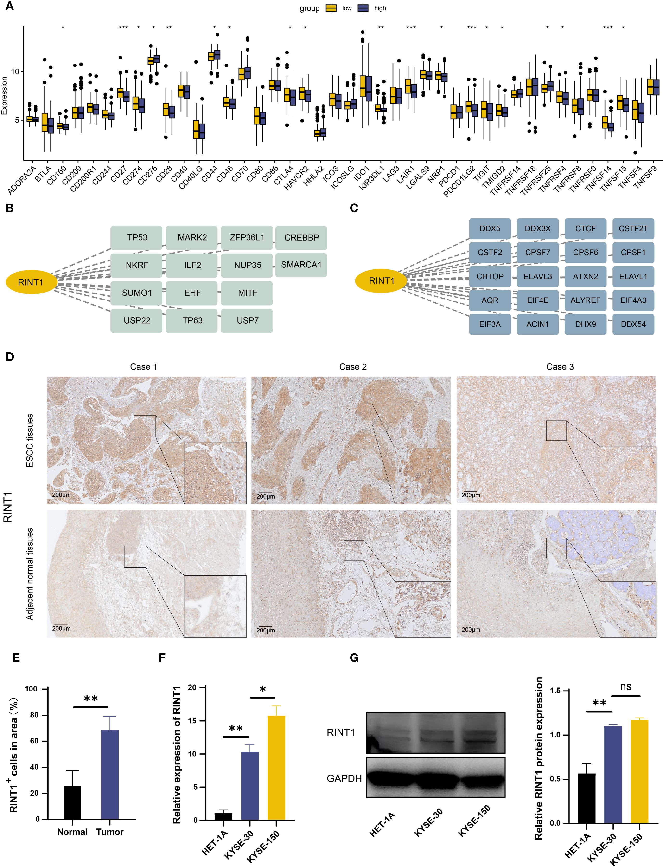 A composite image includes various data visualizations and images related to RINT1 expression. A: Box plots show gene expression comparisons between two groups, distinguished by color. Significant differences are marked. B and C: Interaction diagrams highlight RINT1's connections with multiple proteins. D: Immunohistochemistry images compare esophageal squamous cell carcinoma (ESCC) tissues with adjacent normal tissues across three cases. E: Bar graph indicates higher percentages of RINT1 positive cells in tumor tissues compared to normal tissues. F: Bar graph shows relative RINT1 expression in different cell lines, noting significant differences. G: Western blot and graph display RINT1 protein levels in various cell lines, highlighting statistical significance.