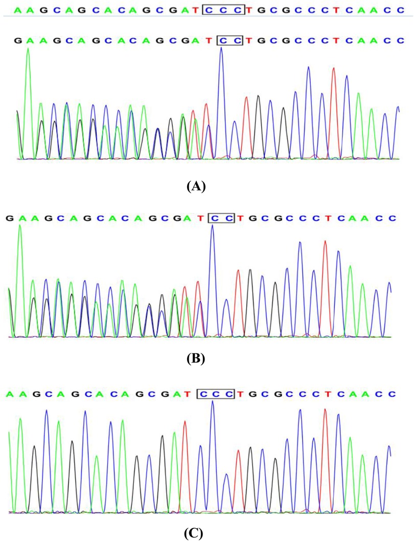 Three DNA sequencing chromatograms labeled A, B, and C, display colored peaks representing nucleotide sequences. Each sequence includes highlighted triplets labeled \