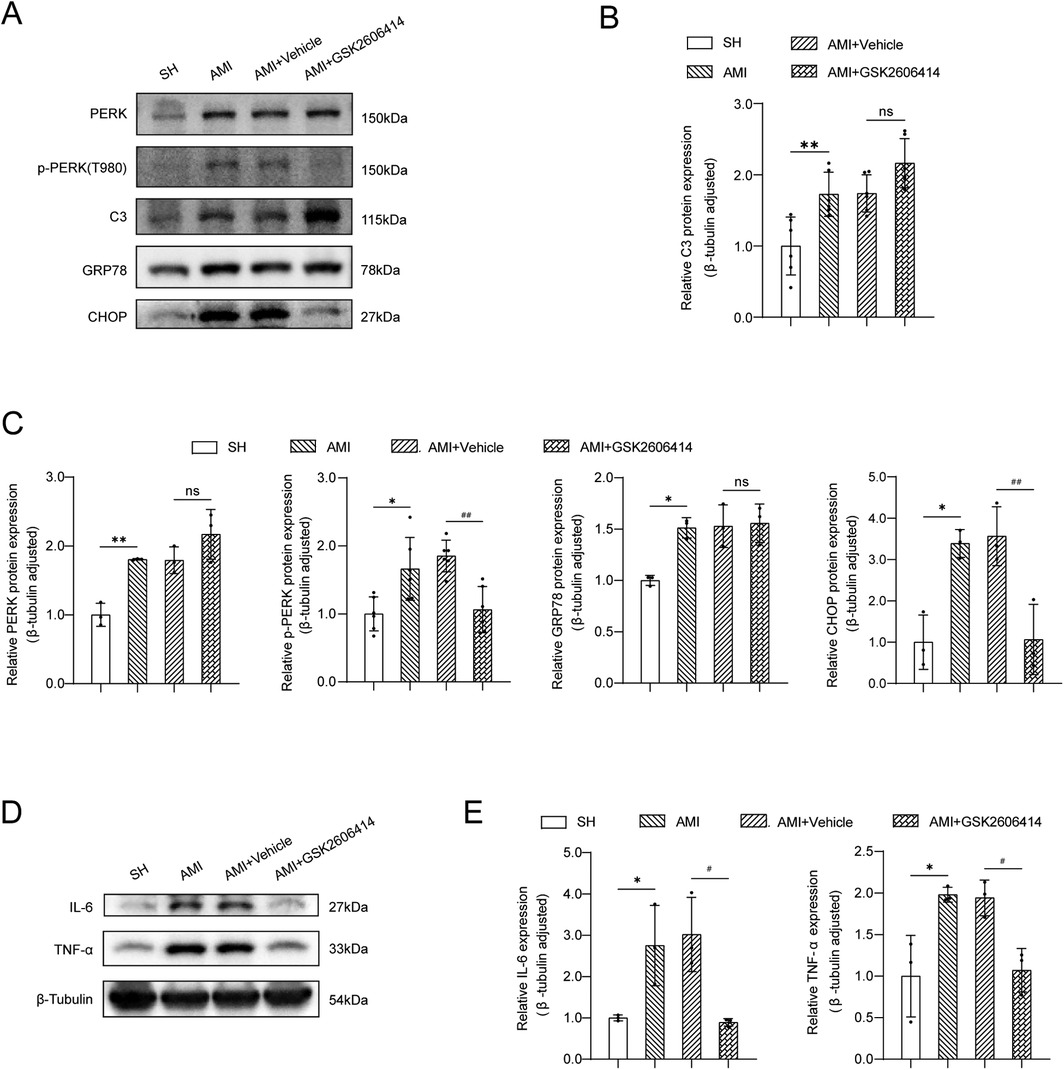 Figure with multiple parts displaying protein expression analysis. Panel A shows Western blots for proteins: PERK, p-PERK, C3, GRP78, CHOP, IL-6, TNF-α, and β-Tubulin across different conditions. Panel B and C present bar graphs comparing relative protein expression levels, showing statistical significance marked by asterisks and \