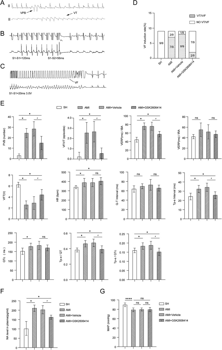Graphs and charts display results of a study on cardiovascular parameters. Panels A, B, and C show electrocardiogram readings indicating VPB, VT, and VF occurrences. Panel D is a bar chart comparing VF induction rates across different treatment groups (SH, AMI, AMI+Vehicle, AMI+GSK2606414). Panel E consists of multiple bar graphs on parameters like PVB number, VF/VT episodes, and various intervals, comparing SH, AMI, AMI+Vehicle, and AMI+GSK2606414 groups. Panels F and G present bar graphs showing NA levels in plasma and MAP comparisons among the groups, with significance levels marked.