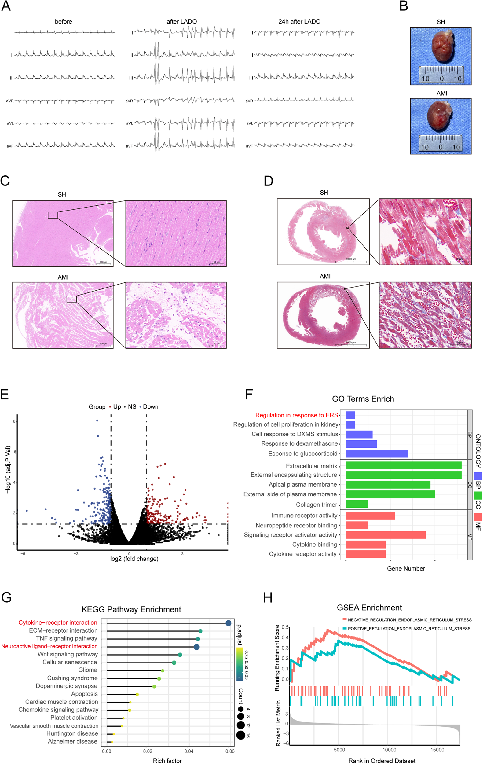 A series of scientific images showing various analyses related to cardiac studies. Panel A displays ECG traces before and after LADO. Panel B shows heart samples with a scale. Panel C presents histological images comparing SH and AMI tissues. Panel D shows cross-sectional views of hearts with close-ups of tissue structures. Panel E features a volcano plot depicting gene expression changes. Panel F is a bar chart for GO Terms Enrichment highlighting various biological processes. Panel G shows a KEGG Pathway Enrichment diagram identifying key pathways. Panel H presents a GSEA Enrichment graph for endoplasmic reticulum stress regulation.