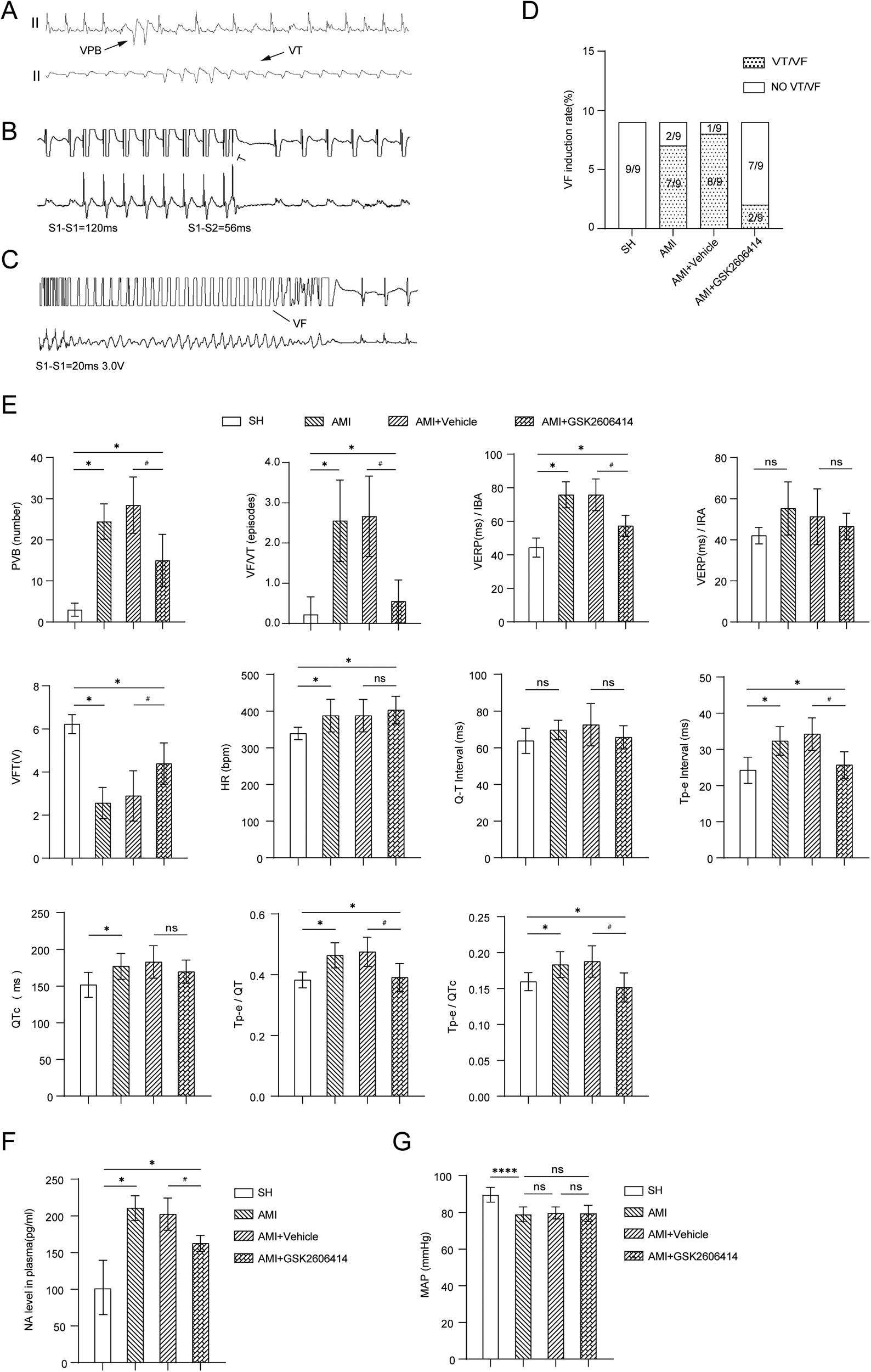 Graphs and charts display results of a study on cardiovascular parameters. Panels A, B, and C show electrocardiogram readings indicating VPB, VT, and VF occurrences. Panel D is a bar chart comparing VF induction rates across different treatment groups (SH, AMI, AMI+Vehicle, AMI+GSK2606414). Panel E consists of multiple bar graphs on parameters like PVB number, VF/VT episodes, and various intervals, comparing SH, AMI, AMI+Vehicle, and AMI+GSK2606414 groups. Panels F and G present bar graphs showing NA levels in plasma and MAP comparisons among the groups, with significance levels marked.