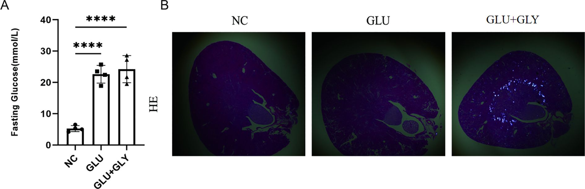 Panel A shows a bar graph illustrating fasting glucose levels (mmol/L) for three groups: NC (normal control), GLU, and GLU+GLY. The GLU and GLU+GLY groups have significantly higher glucose levels than NC, indicated by asterisks. Panel B displays three histological images of tissue sections labeled NC, GLU, and CLU+GLY. Each section shows varying degrees of staining and structural differences.