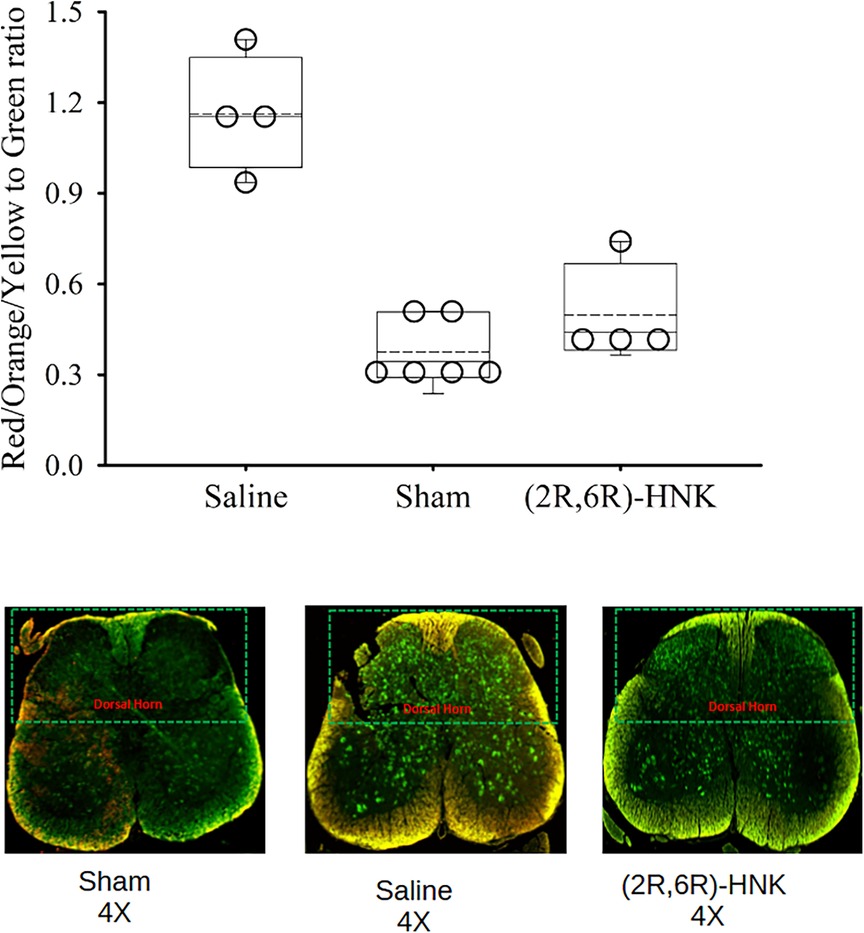 Box plot and fluorescent spinal cord images compare the ratio of red/orange/yellow to green signal intensity in the dorsal horn among saline, sham, and (2R,6R)-HNK-treated groups. The saline group shows a higher color ratio, indicating greater red/yellow signal, while sham and HNK groups display significantly lower ratios, suggesting reduced inflammation or neural activation. Corresponding 4X magnification images confirm these trends, with the saline group exhibiting more yellow-orange fluorescence and the HNK group showing predominant green signal in the dorsal horn region.