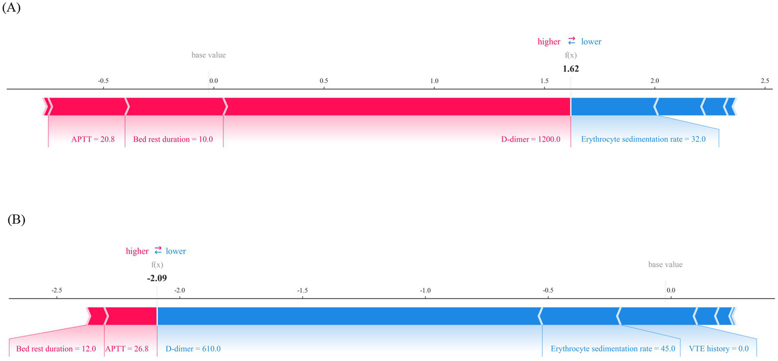 Graphical representation of two probabilistic profiles, labeled A and B. In A, the probability of a higher value is represented in red, including APTT at 20.8, bed rest duration at 10.0, and D-dimer at 1200.0, while the probability of a lower value is shown in blue, with erythrocyte sedimentation rate at 32.0. The overall function value is 1.62. In B, red indicates higher values for bed rest duration at 12.0, and APTT at 26.8. Blue indicates lower values for D-dimer at 610.0, erythrocyte sedimentation rate at 45.0, and VTE history at 0.0, with a function value of -2.09.