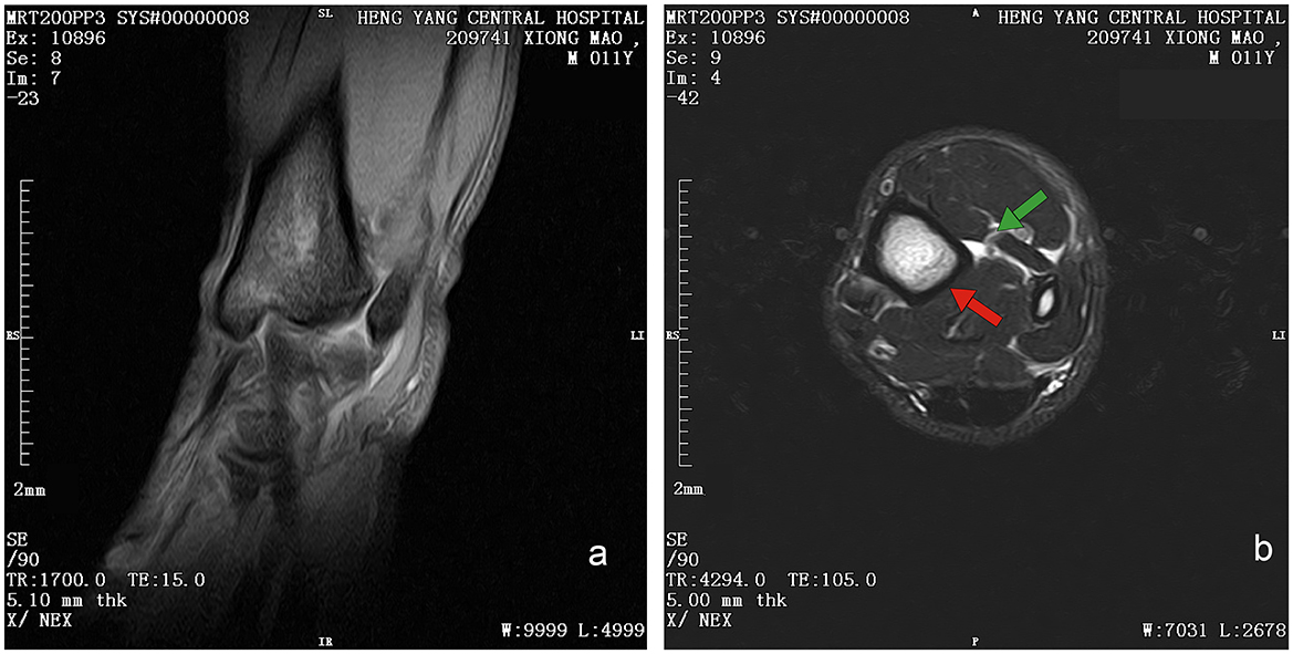 MRI scans of an ankle are shown. Image (a) is a sagittal view displaying bone and soft tissue structures. Image (b) is an transverse view with a red arrow pointing to soft tissue and a green arrow indicating bone. Both images are labeled with hospital and scan details.