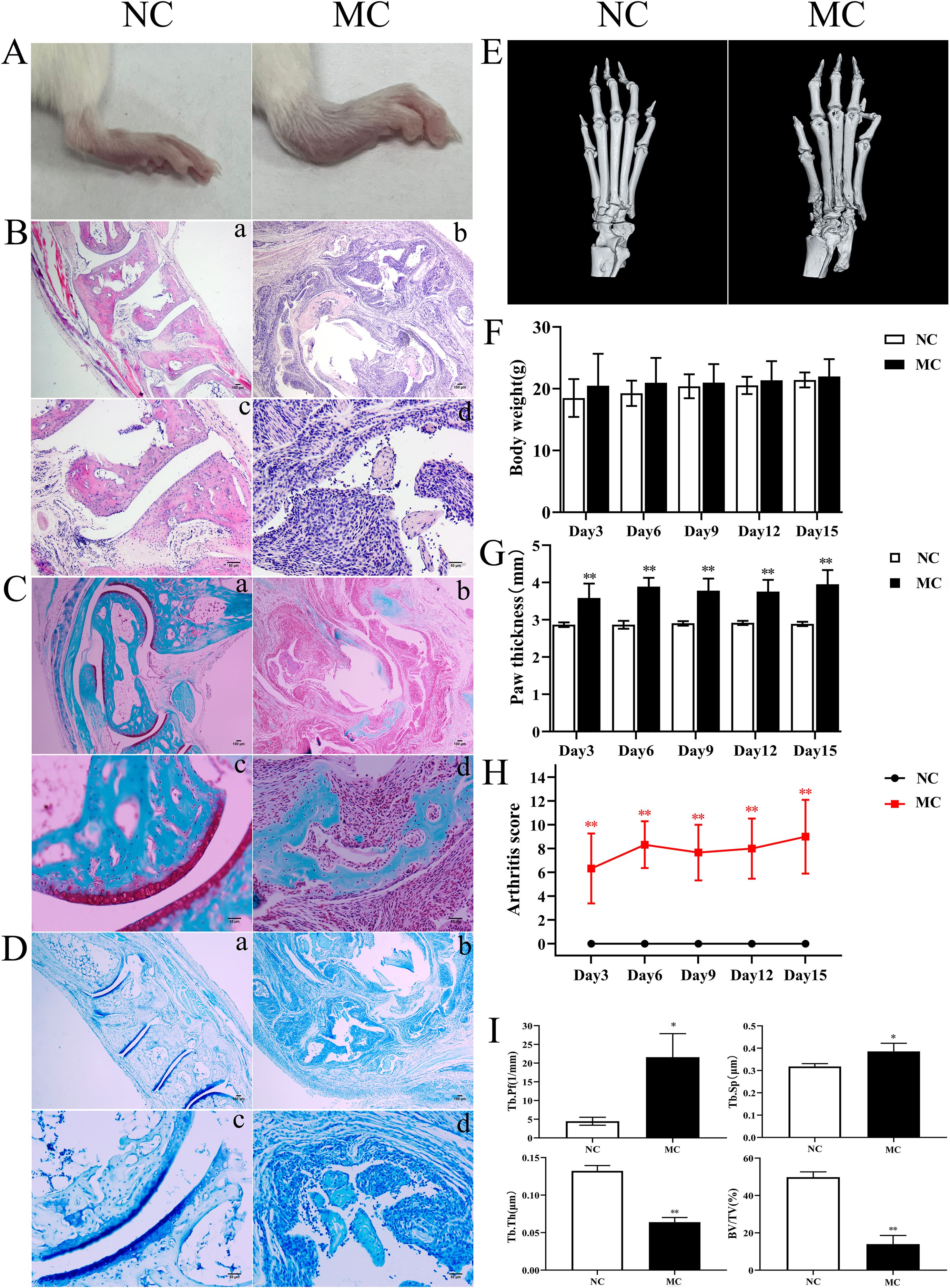 Panel A shows images of rat paws under normal control (NC) and model control (MC) conditions. Panel B presents histological slides with differences in tissue structure between NC and MC groups. Panel C features stained tissue samples highlighting cartilage and bone distinctions. Panel D displays further tissue slides showing bone integrity. Panel E has x-ray images comparing NC and MC skeletal structures. Panel F is a bar chart of body weight over 15 days for both groups. Panel G shows paw thickness over time. Panel H is a line graph of arthritis scores. Panel I presents bar graphs of bone metrics like thickness and density.