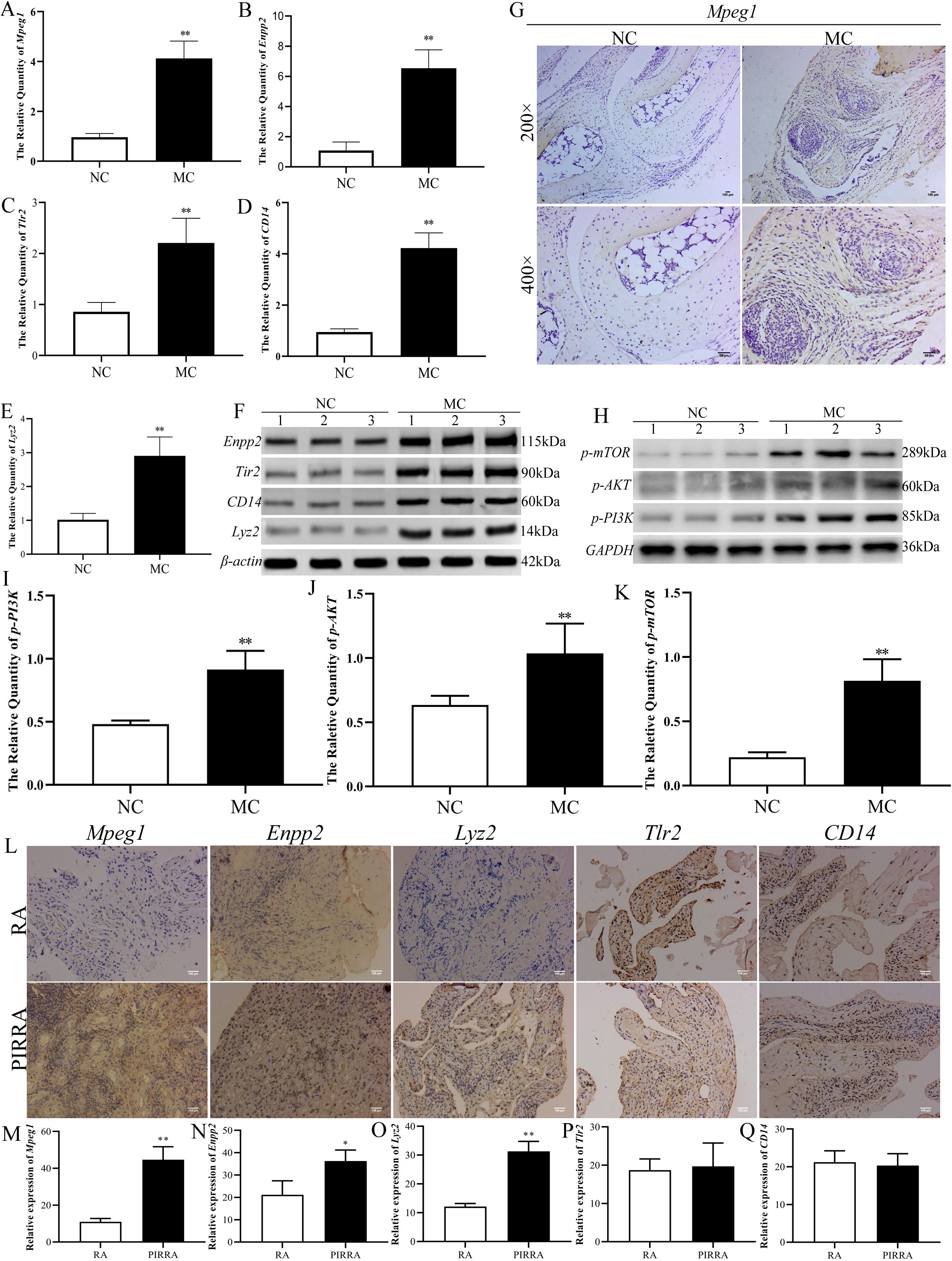 Western blot and immunohistochemistry images with corresponding bar graphs showing expression levels of Mpeg1, Enpp2, Lyz2, Tlr2, CD14, p-mTOR, p-AKT, and p-PI3K. The graphs compare expression in NC against MC, and RA against PIRRA groups, highlighting significant differences. Magnifications in panel G show tissue staining at 200x and 400x for Mpeg1 in NC and MC. Panels L and M-Q present additional staining and expression comparisons between RA and PIRRA groups, showing varied protein expressions.